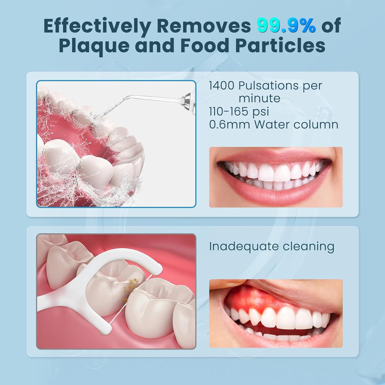 Irrigador Oral Portátil SweetLF HF-P11-2, 5 Modos, 300ML
