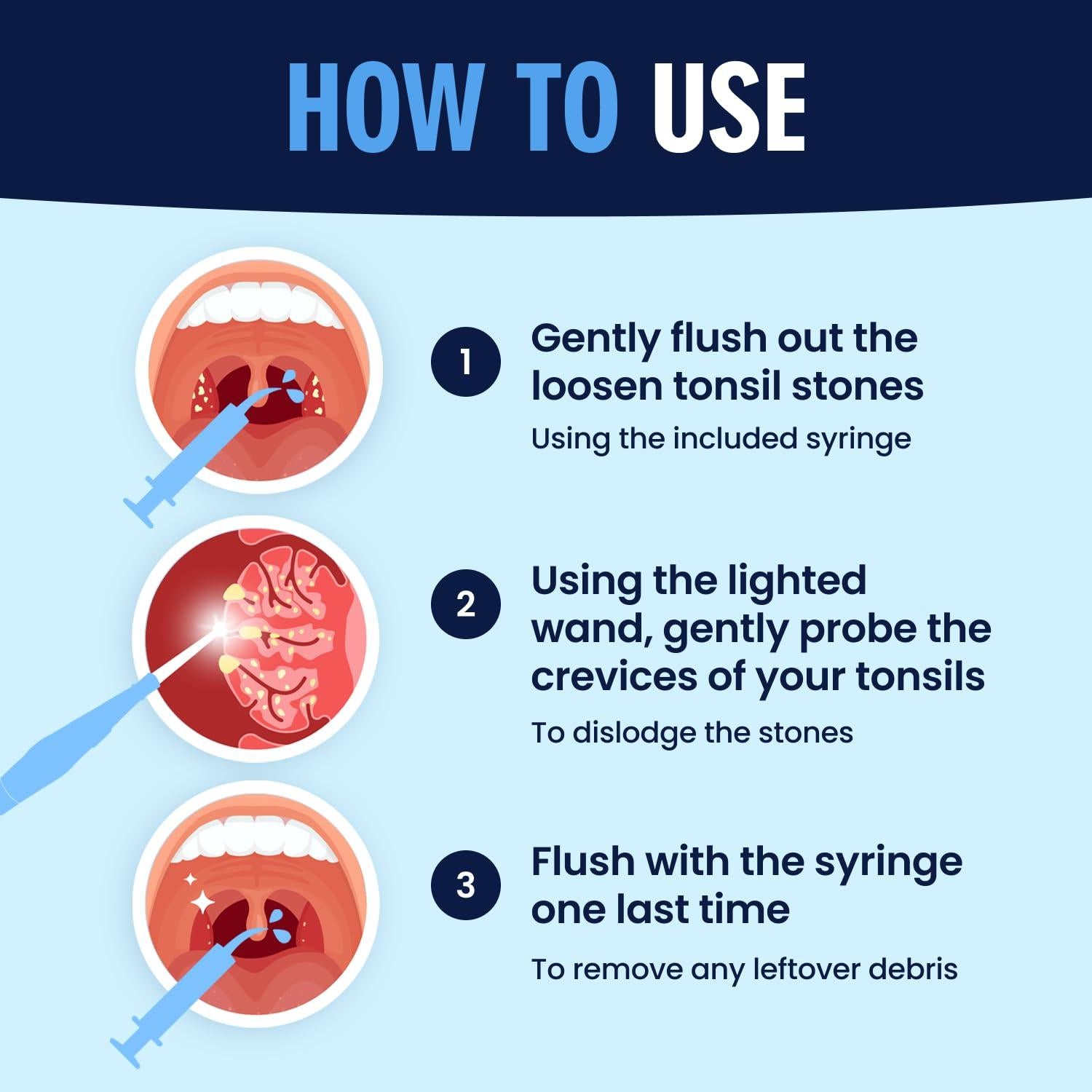 Kit de Remoción de Piedras de Amígdalas Dr. Frederick - 8 Piezas