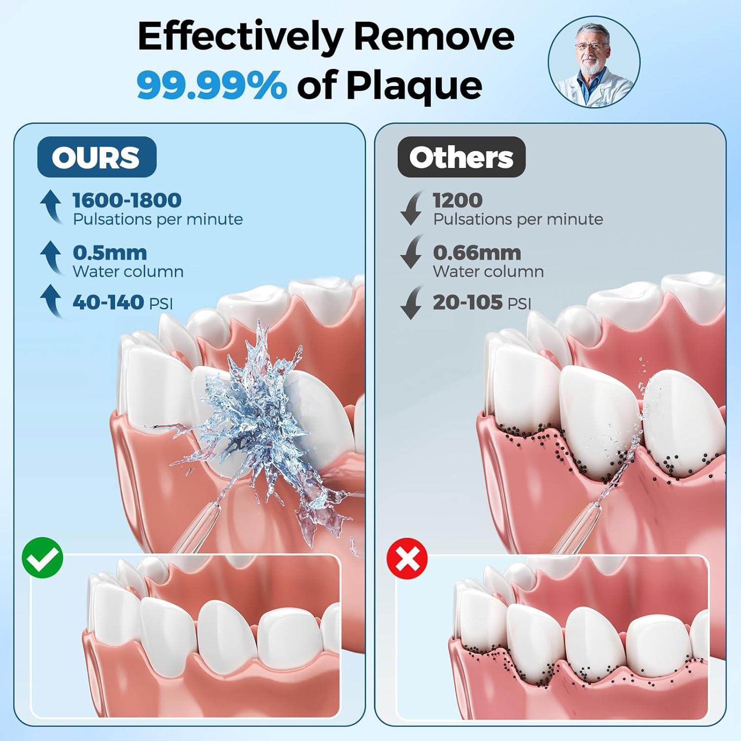 Irrigador Oral Portátil URSMILEKIT L-10 350ml IPX7 Blanco