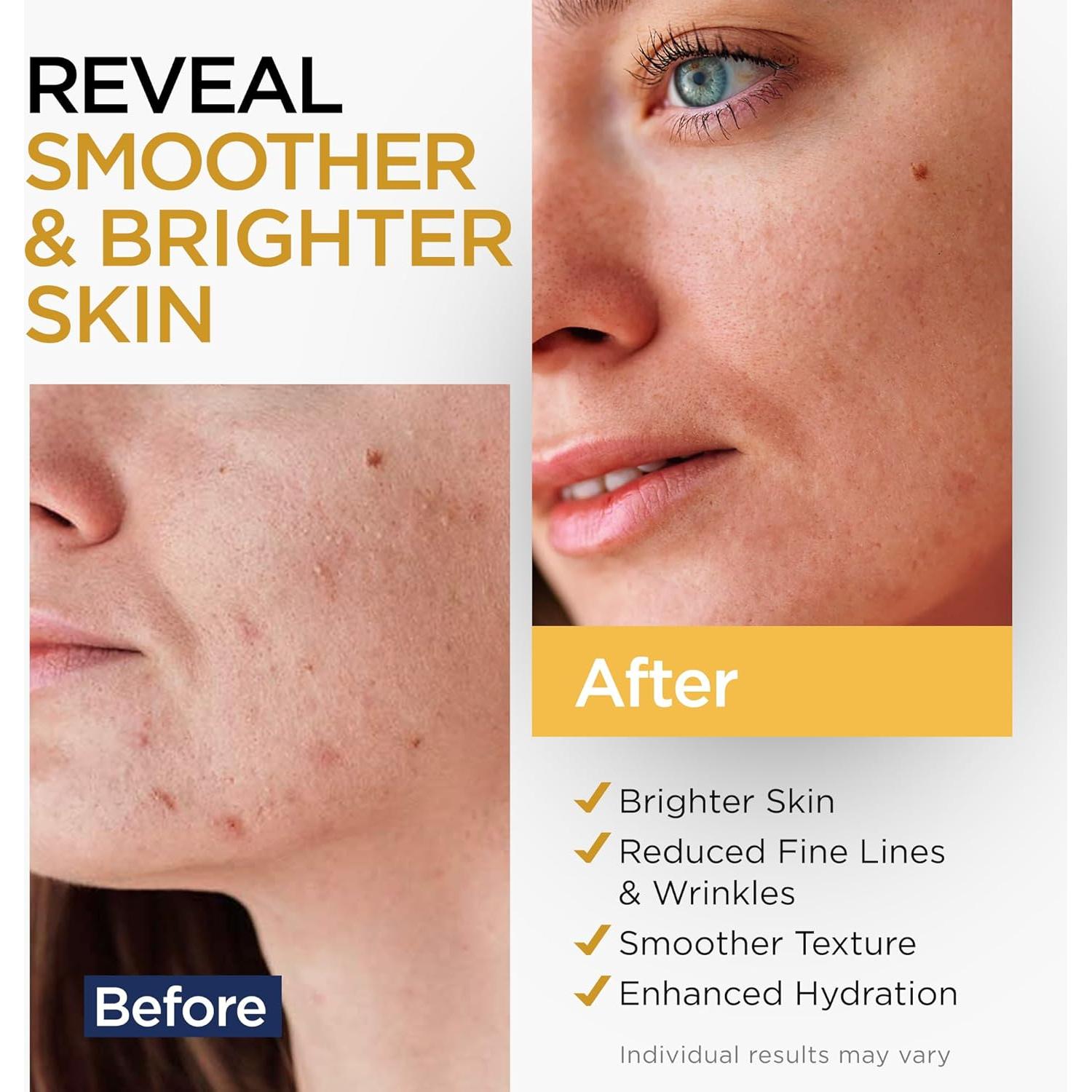 Suero Antienvejecimiento Vitamina C Ember Cloud 28.35 ml