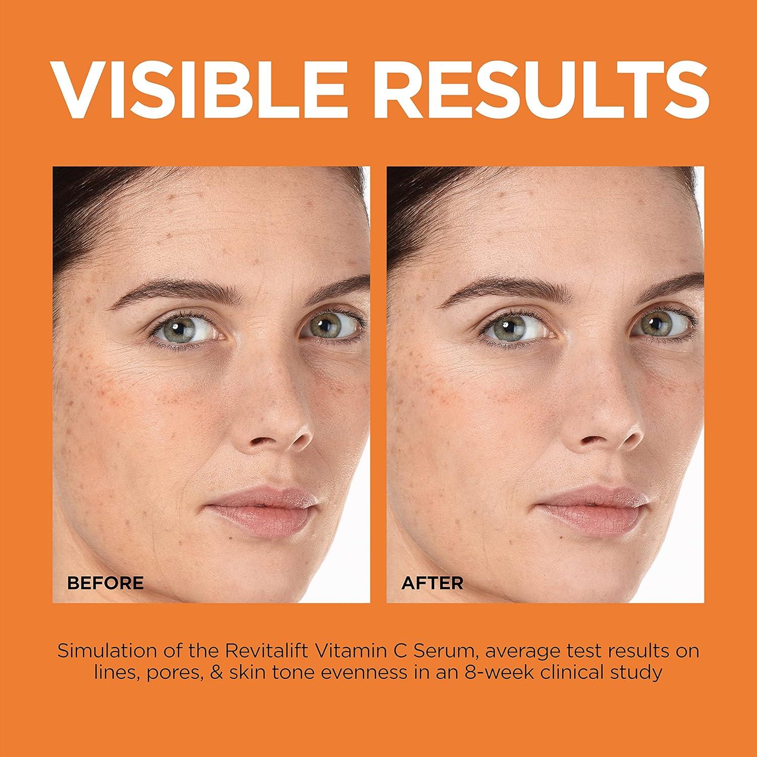 Suero Iluminador L'Oreal Paris 12% Vitamina C 28.35 g