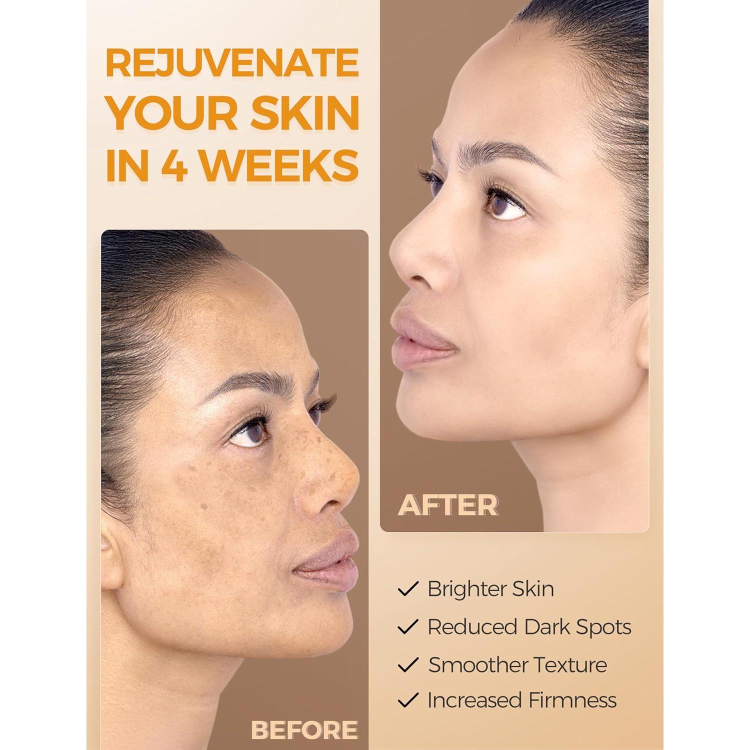 Suero Facial Vitamina C Ning Dermologie 28.5ml Antienvejecimiento