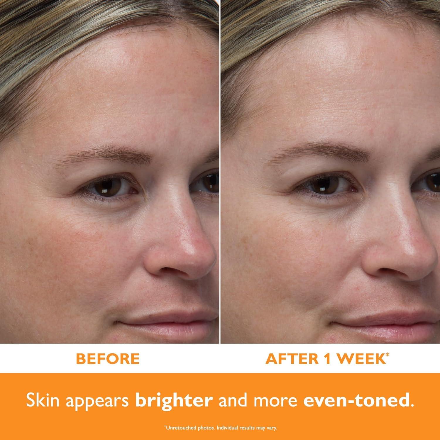 Suero Potent-C Peter Thomas Roth 30g - Vitamina C 20%