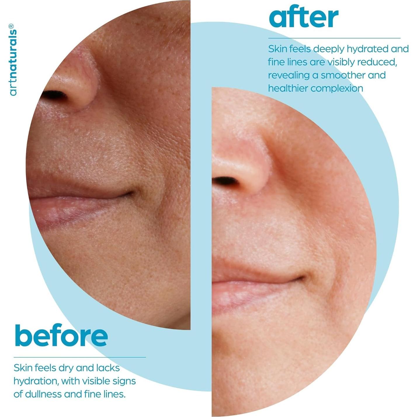 Suero Facial Antienvejecimiento ArtNaturals 29.57 ml - Ácido Hialurónico, Vitamina C y E