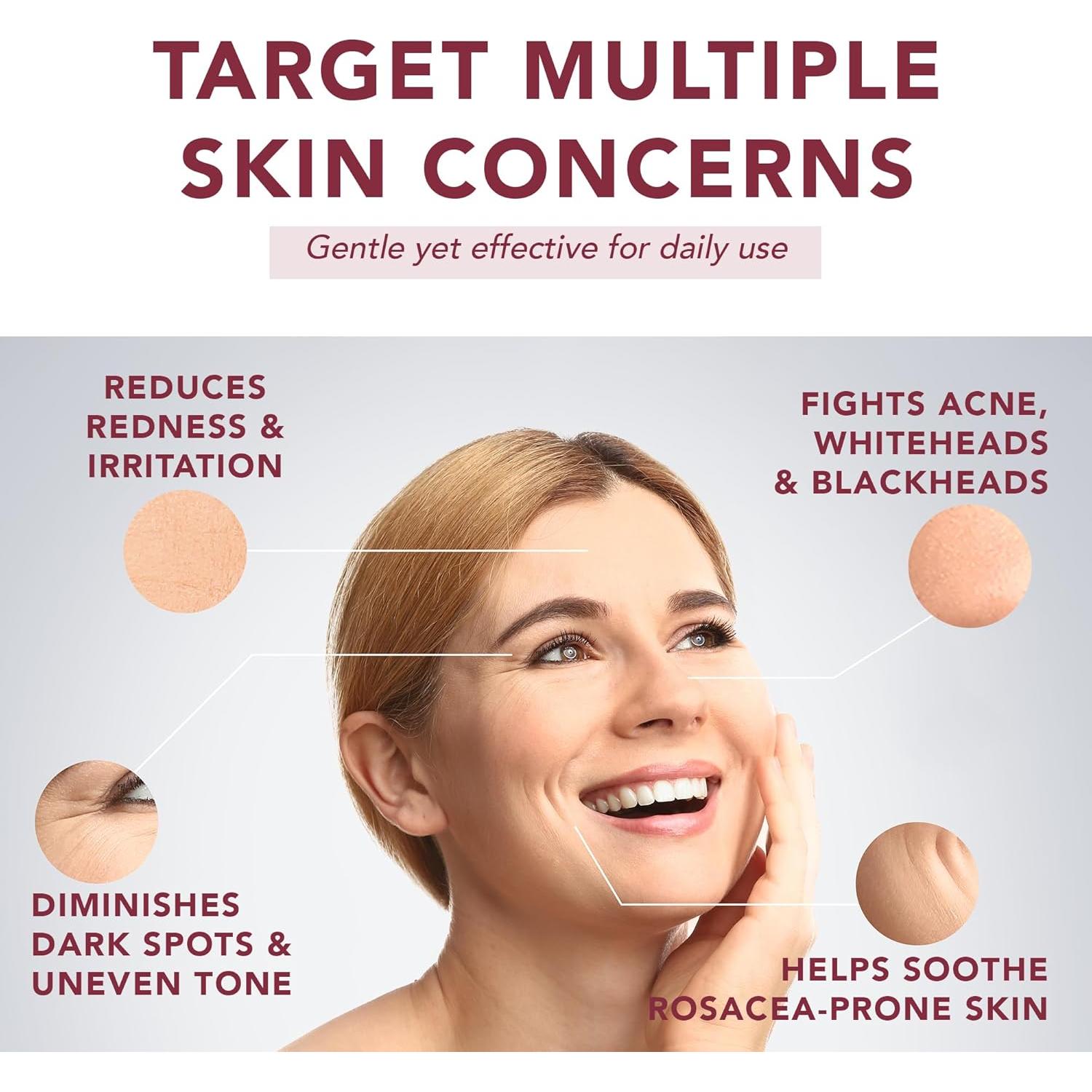 Suero Facial Suquato 30ml - Ácido Azelaico 10% + Niacinamida