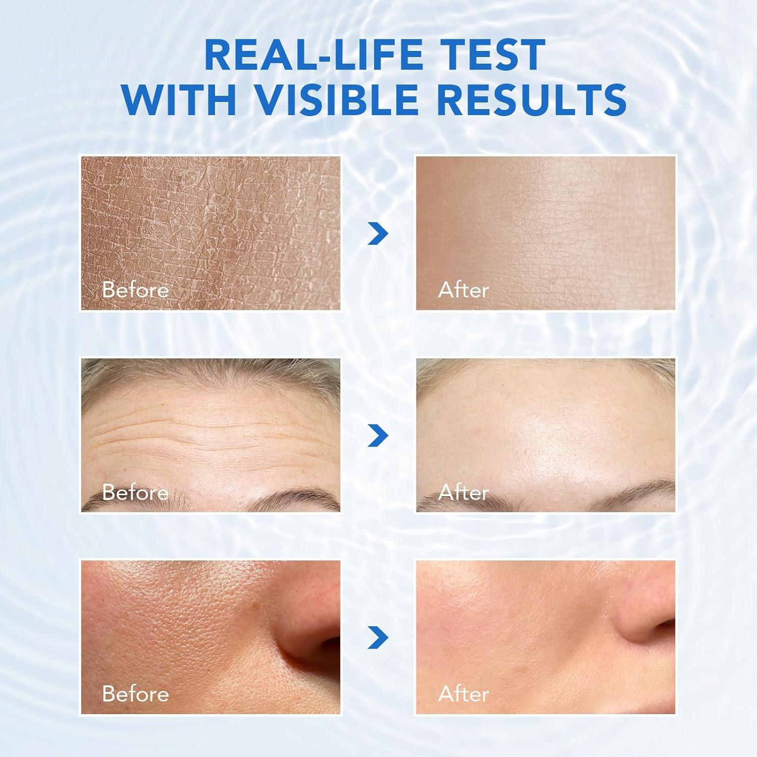 Suero Ultra Ácido Hialurónico ReliCo 60PCS Hidratación Intensiva