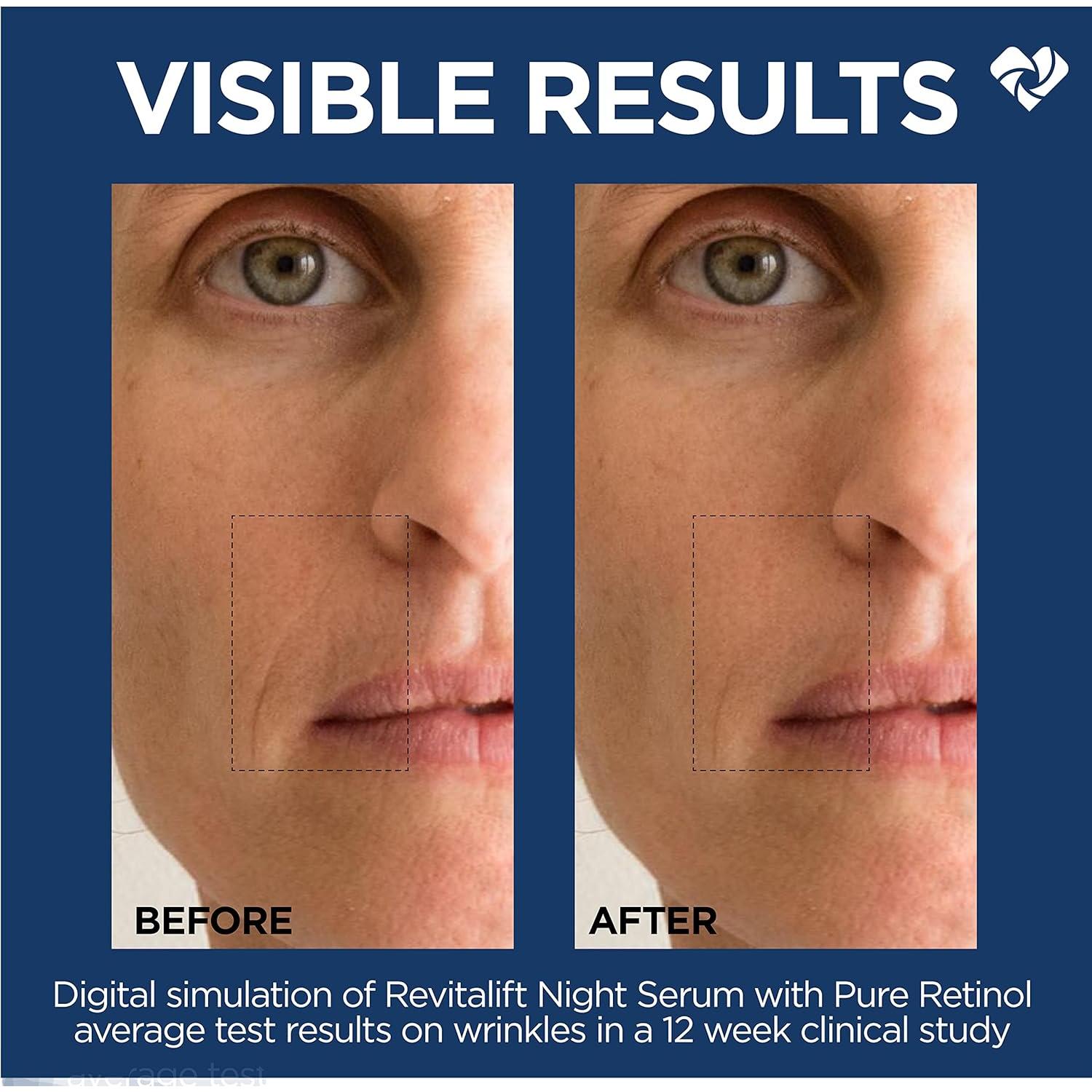 Suero Nocturno L'Oreal Paris Revitalift 0.3% Retinol 28.35 g