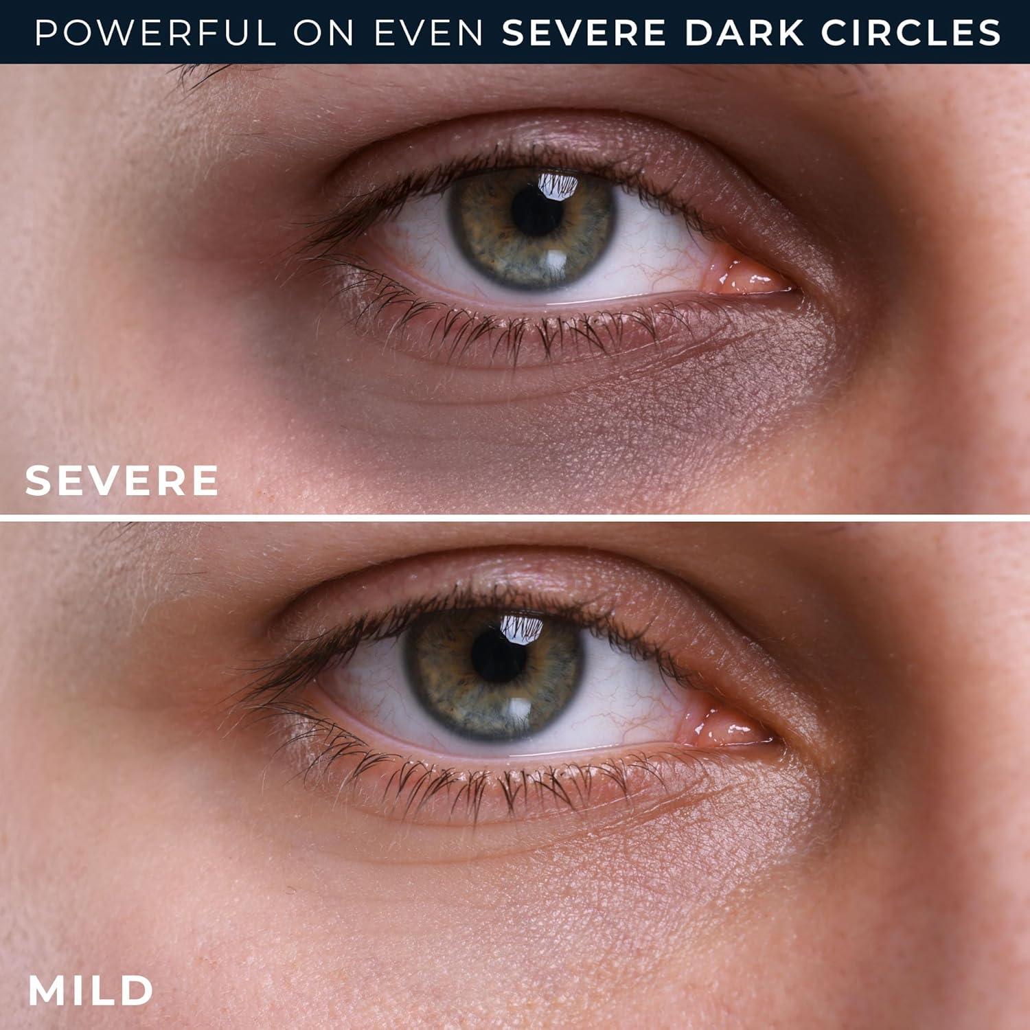 Crema para Ojeras RoC Derm Correxion 55g - Antiarrugas y Revitalizante