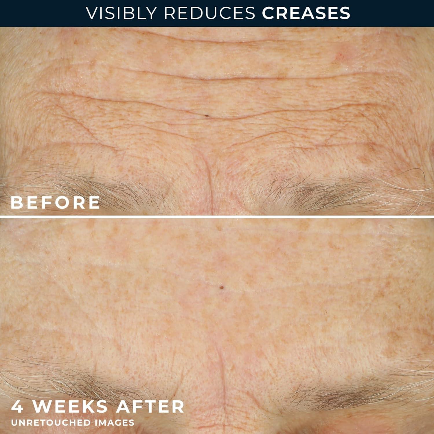 Crema Hidratante Facial Anti Envejecimiento RoC 48g + Cápsulas Retinol 7ct