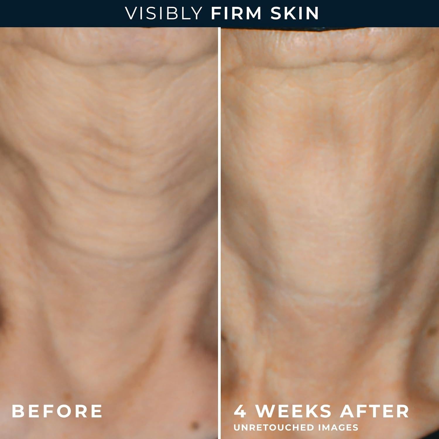 Crema Hidratante Facial Anti Envejecimiento RoC 48g + Cápsulas Retinol 7ct