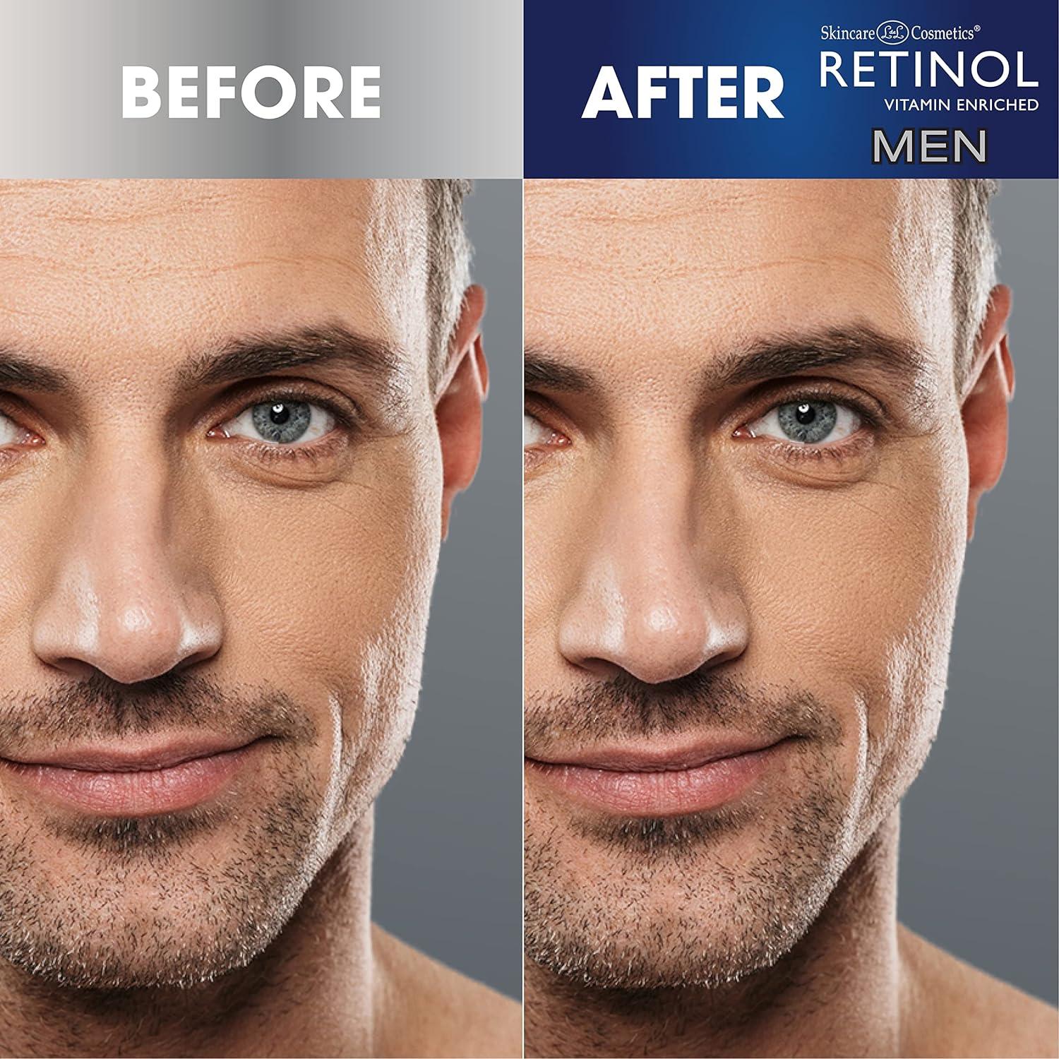 Hidratante Diario de Retinol para Hombres Retinol 50g