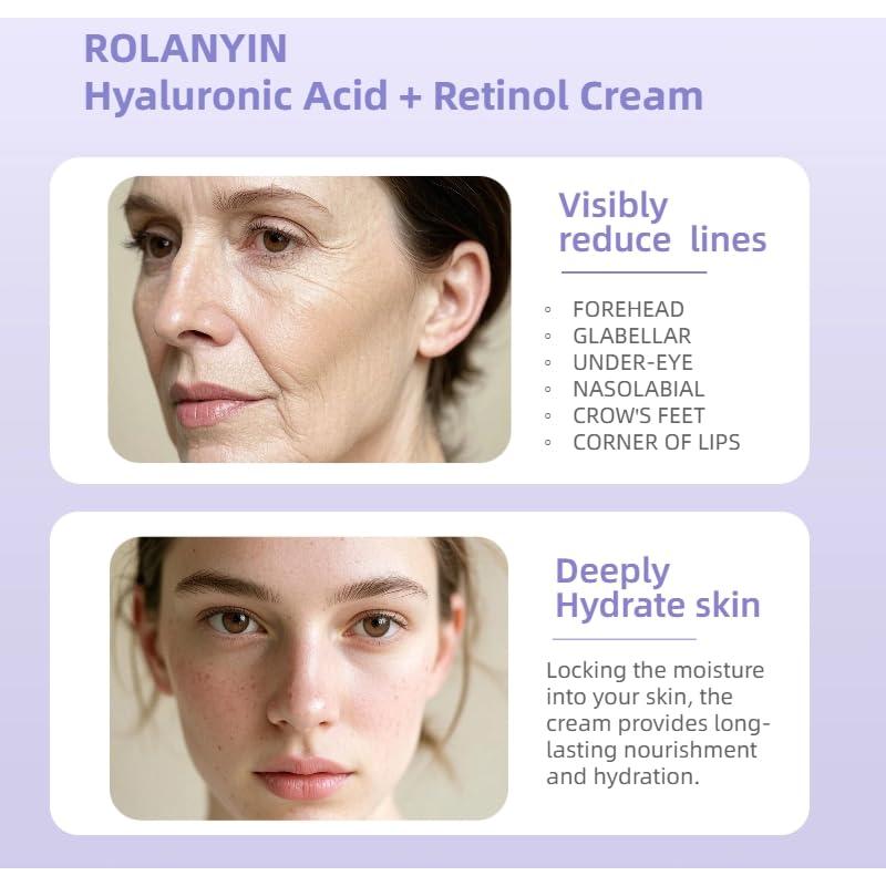 Crema Anti-Envejecimiento ROLANYIN 50ml Ácido Hialurónico + Retinol