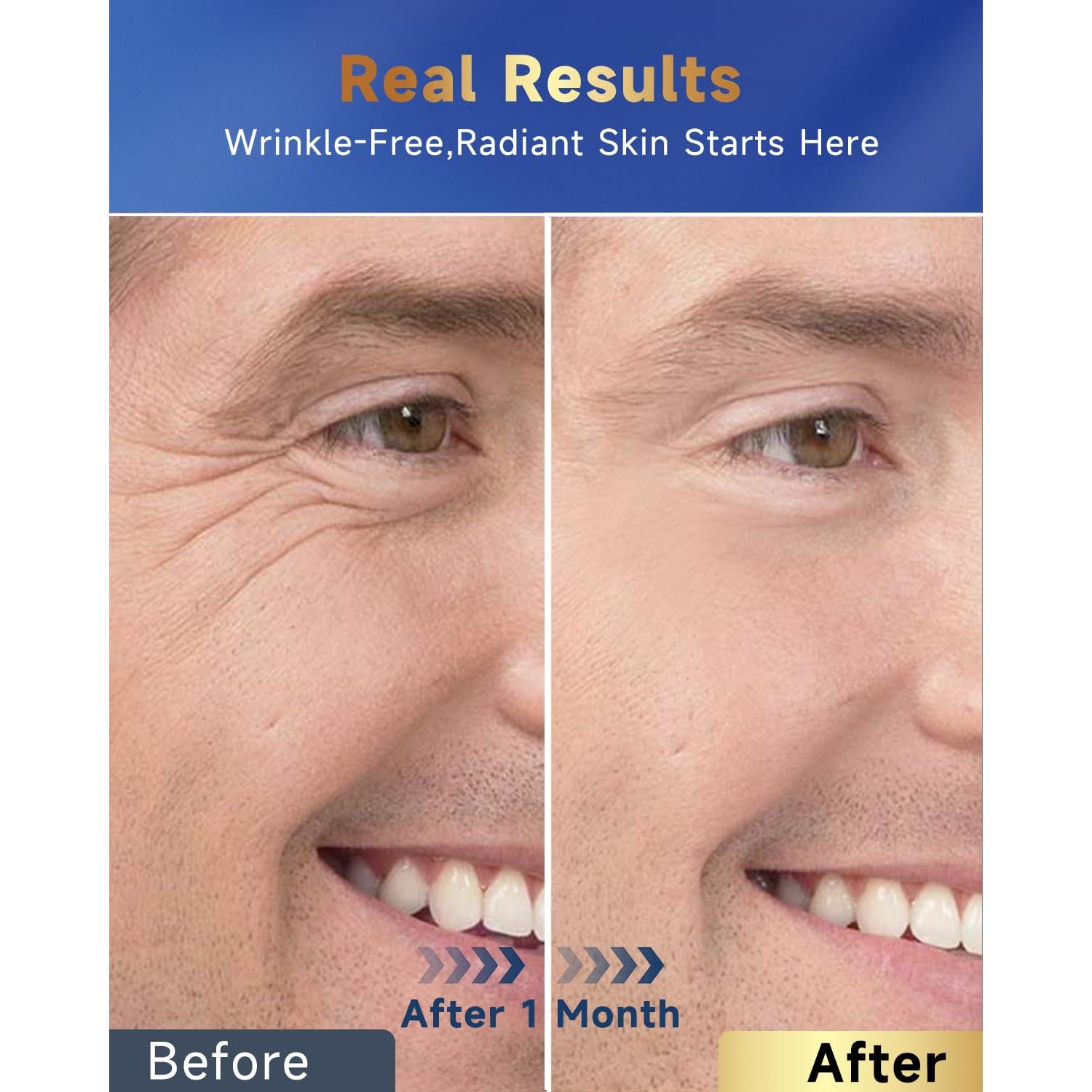 Crema Facial 6 en 1 para Hombres Felicemy 50 ml Hidratante Antienvejecimiento