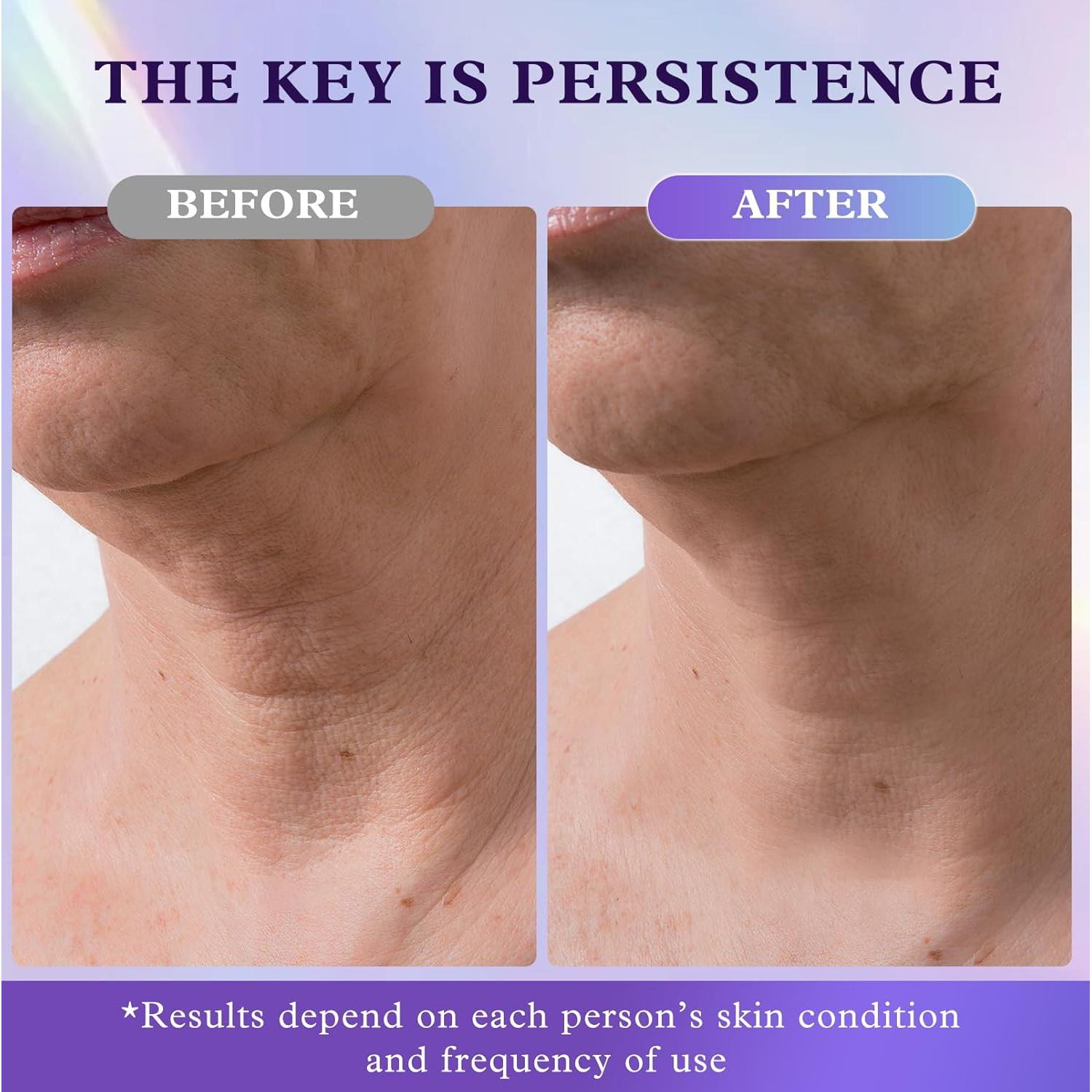 Crema Antiarrugas para Cuello y Cara UKVOA 50ml con Retinol