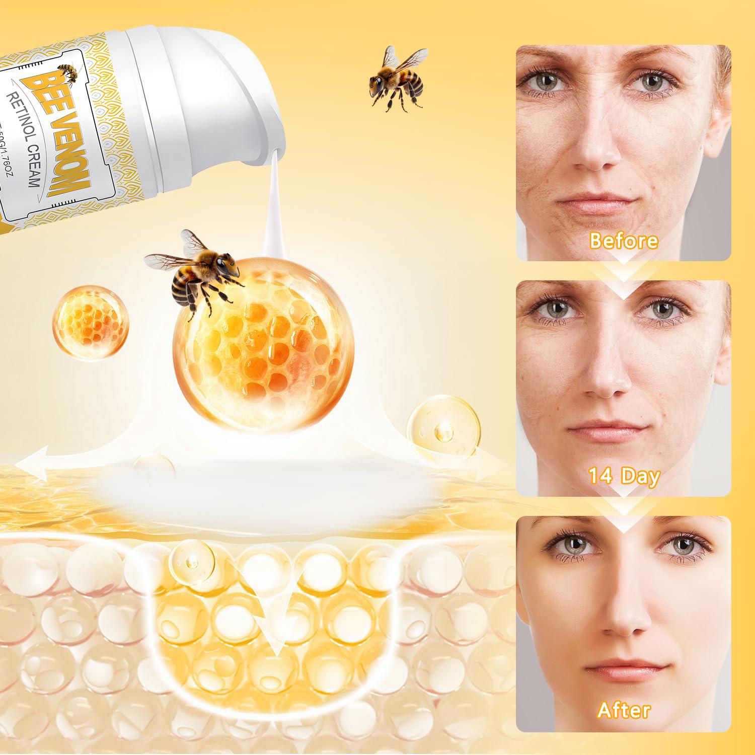 Crema de Piel de Veneno de Abeja Retinol YIVANNUO 191g