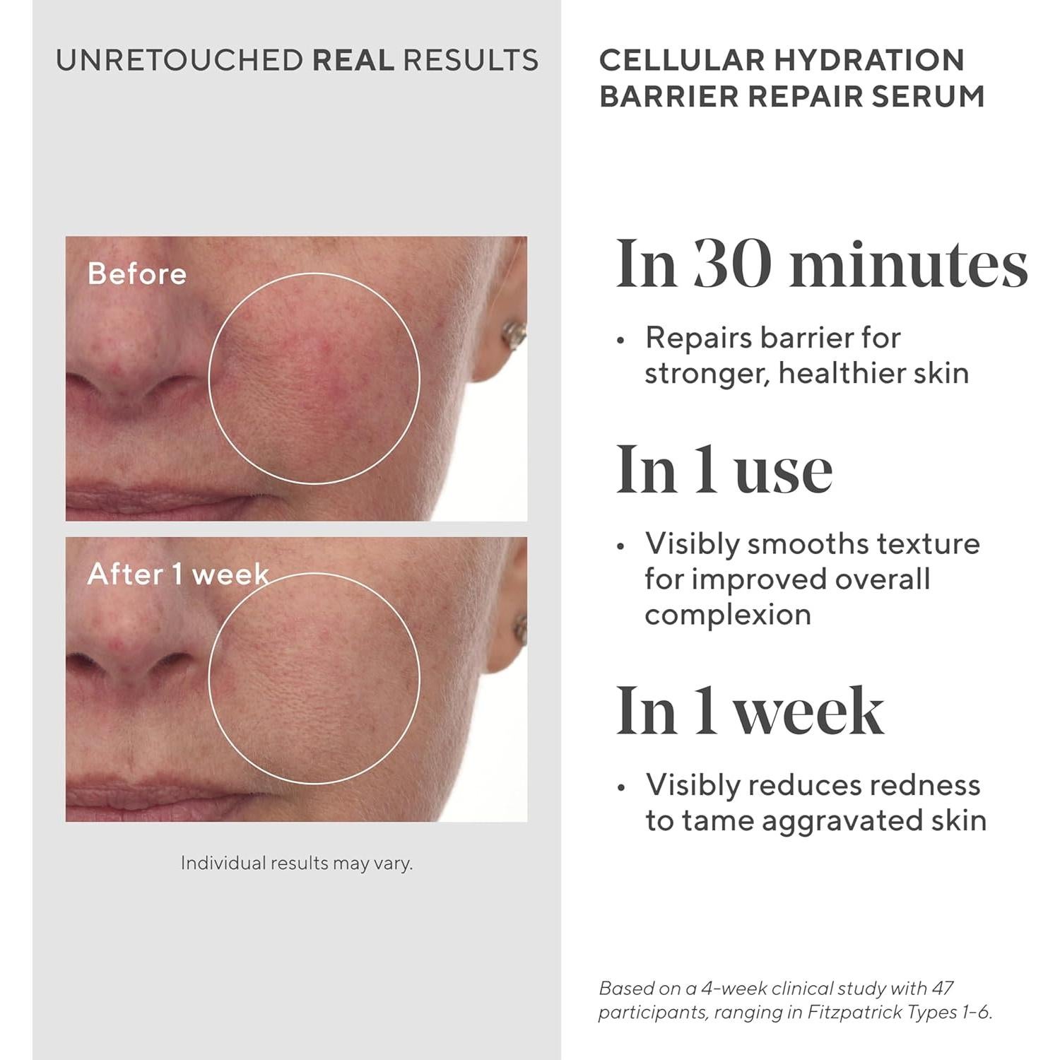 Suero Hidratante Murad 28g - Repara Barrera Piel Saludable