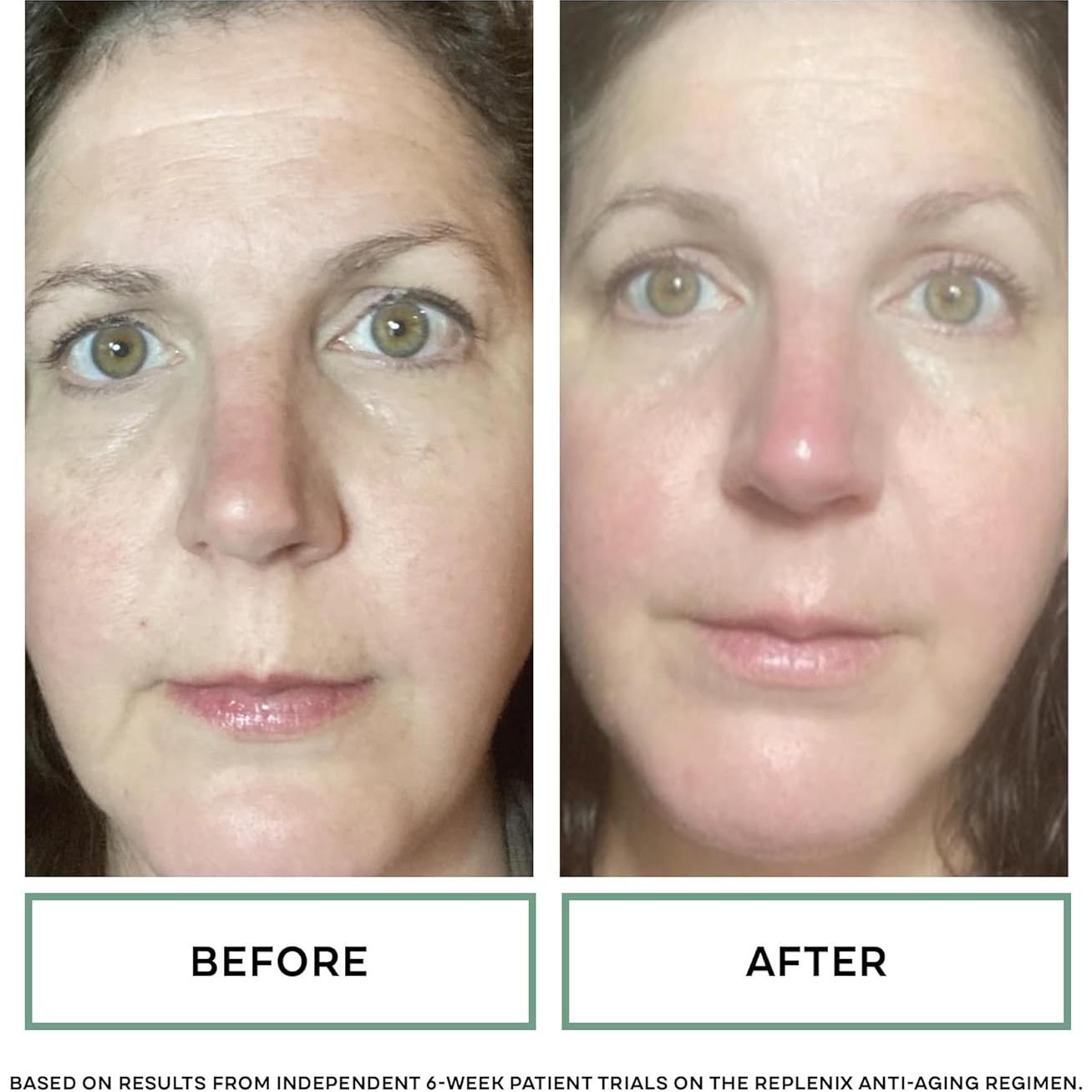 Suero Hidratante Replenix Ácido Hialurónico 29.57 ml