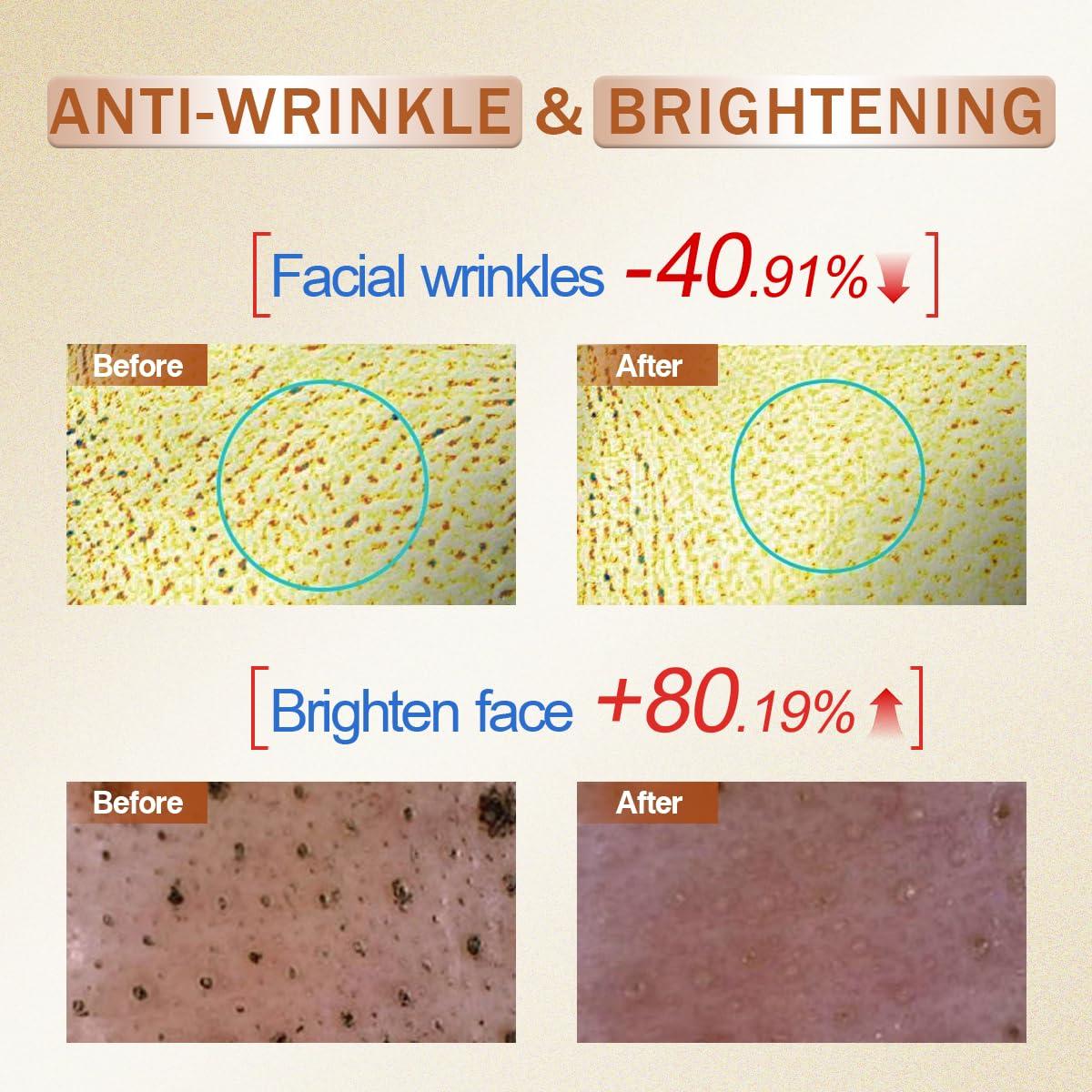 Suero Facial de Vitamina C Peunitory 30ml - Antienvejecimiento