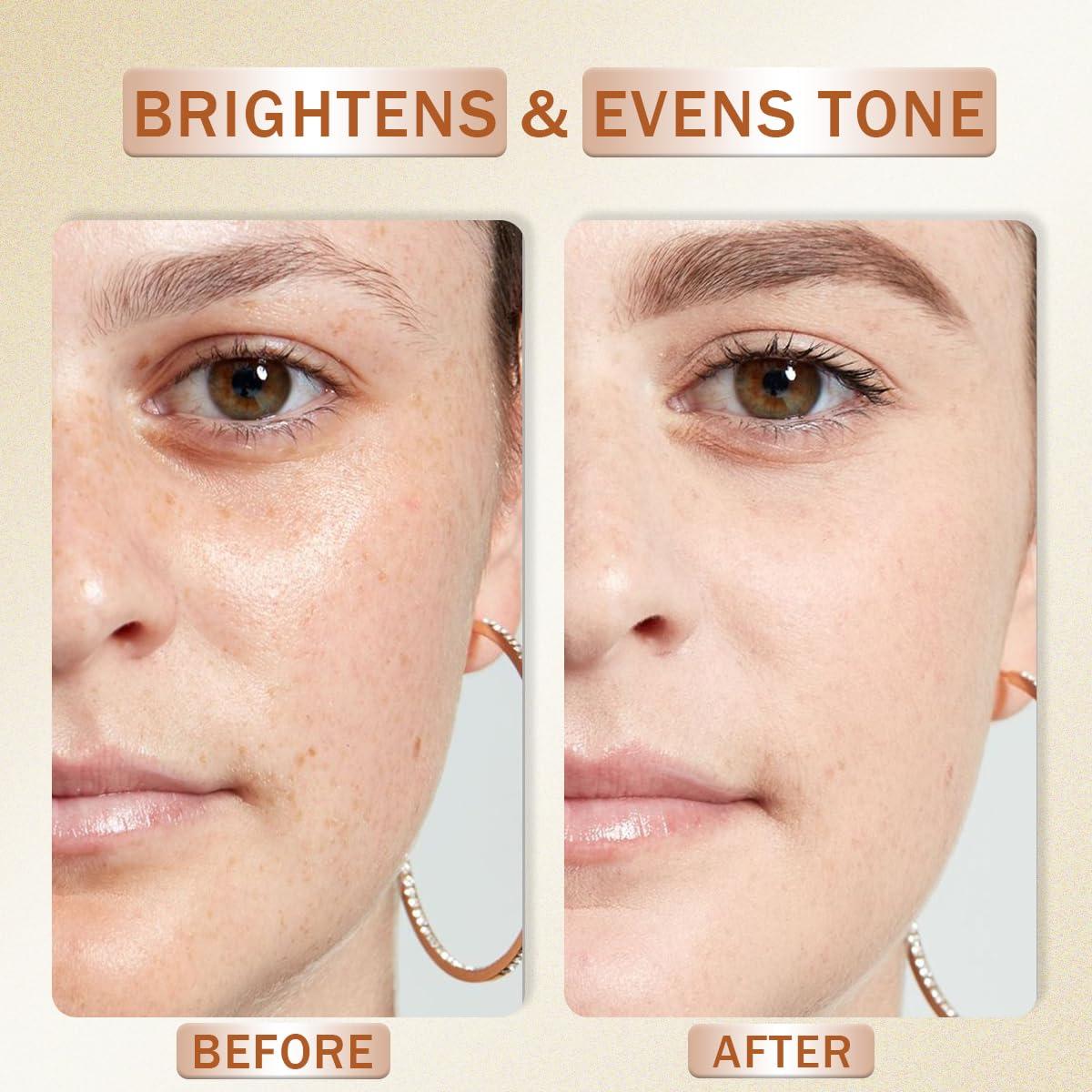 Suero Facial de Vitamina C Peunitory 30ml - Antienvejecimiento