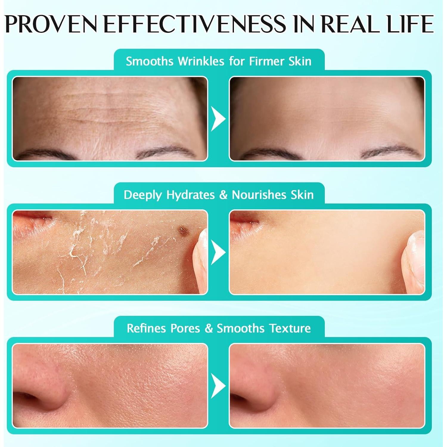 Suero Facial Hidratante 3% Ácido Hialurónico Meifenla 30 Viales