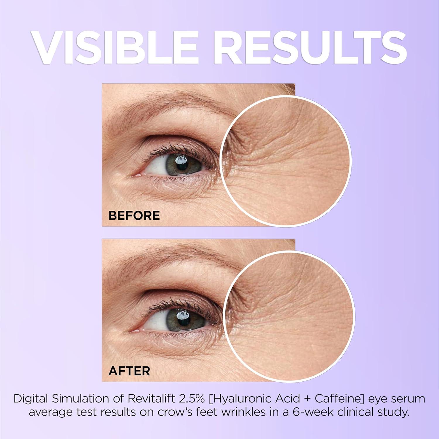 Suero Hidratante para Ojos L'Oreal Paris Revitalift 19.9 ml