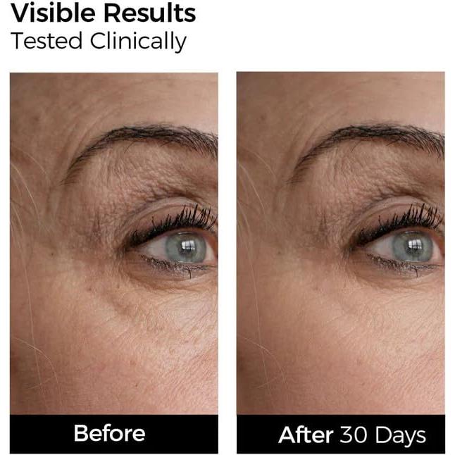 Suero de Colágeno WNP 36ml con Ácido Hialurónico 4D