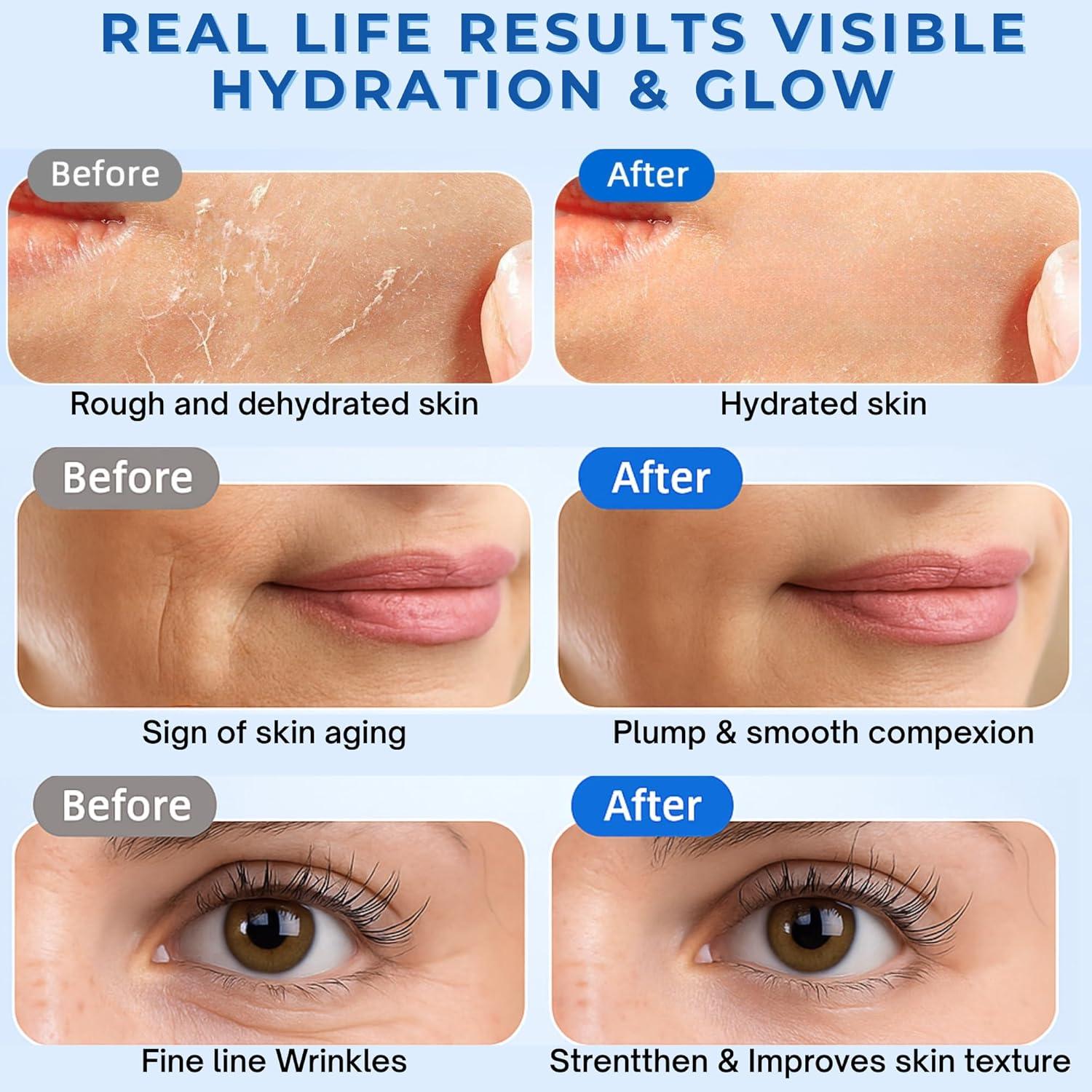 Suero Hidratante PHAAMESTIC 3% Ácido Hialurónico 30 Viales