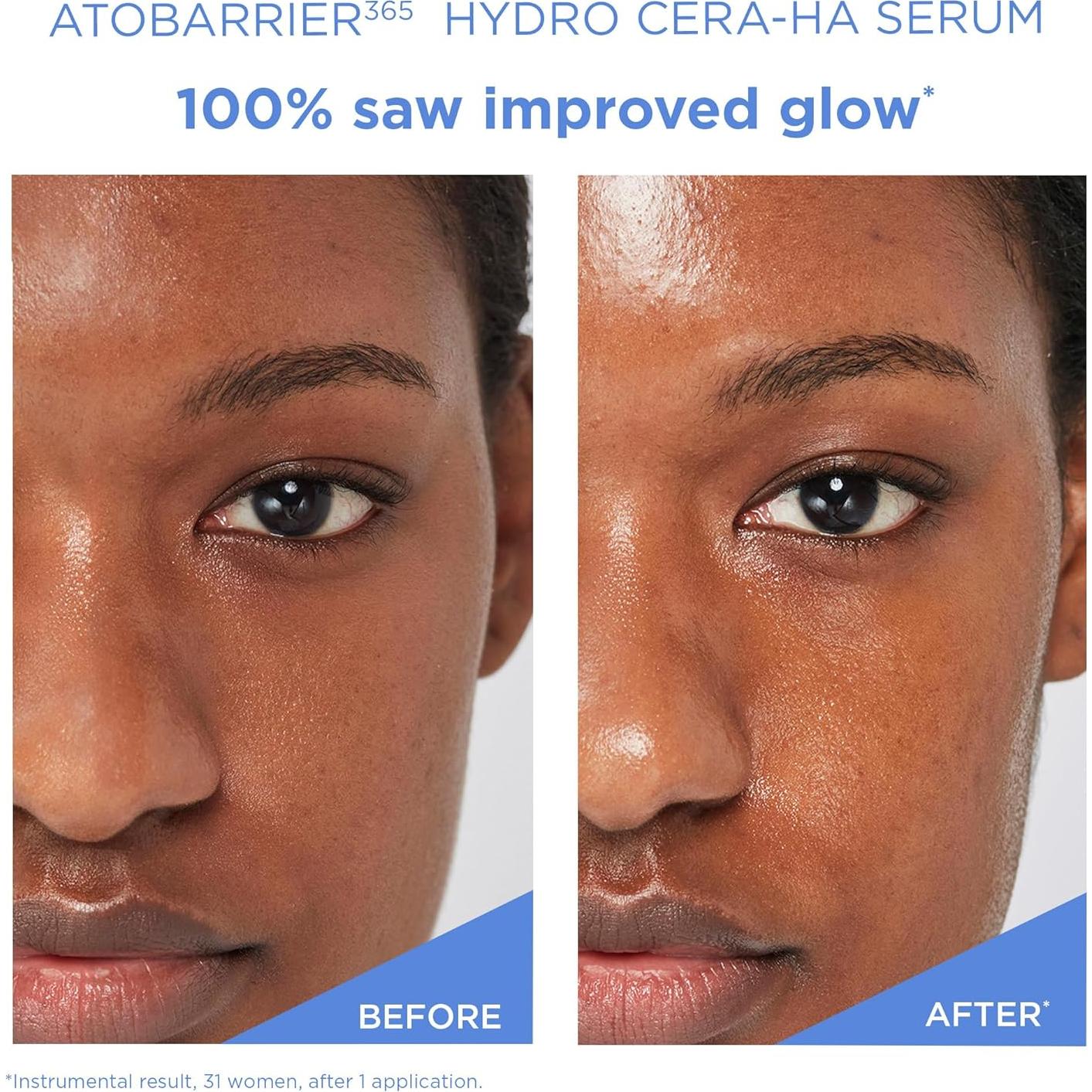 Suero Facial AESTURA ATOBARRIER365 30ml - Ceramida y Ácido Hialurónico