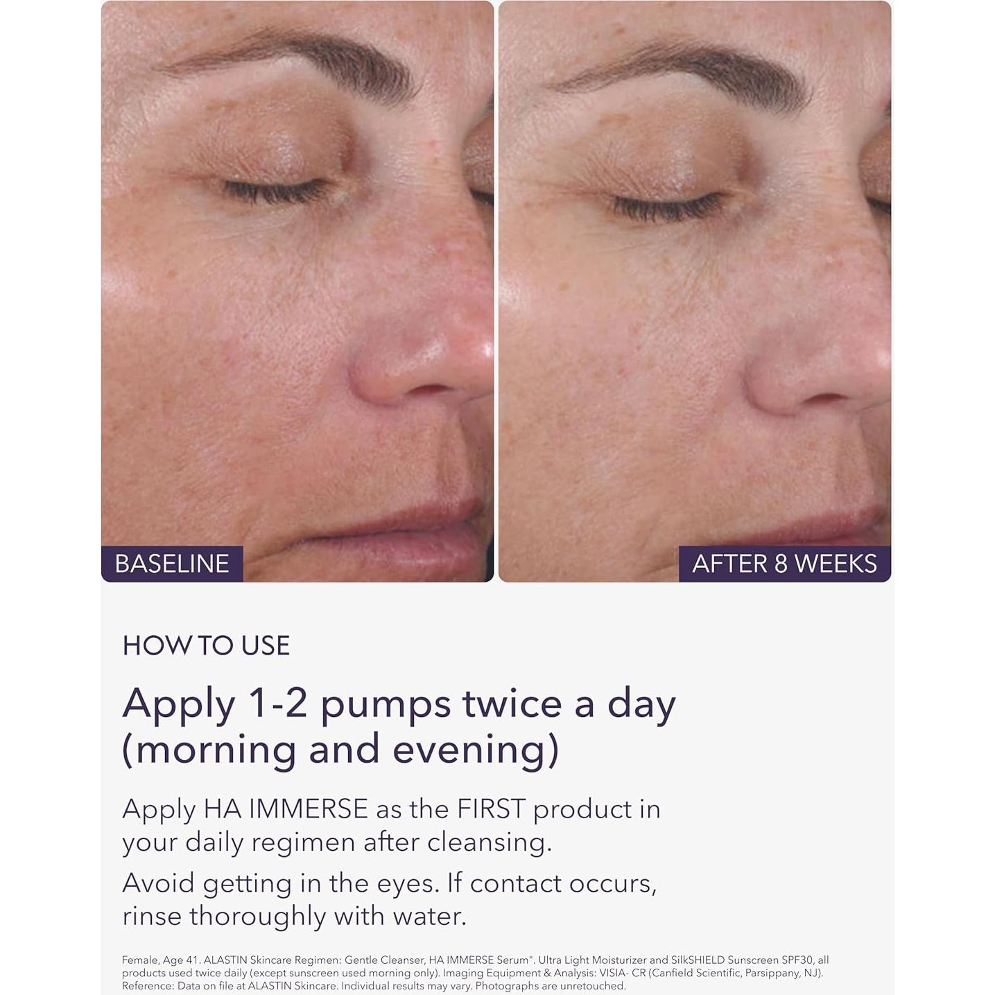 Suero Hidratante Ácido Hialurónico Alastin HA IMMERSE 28.35 g