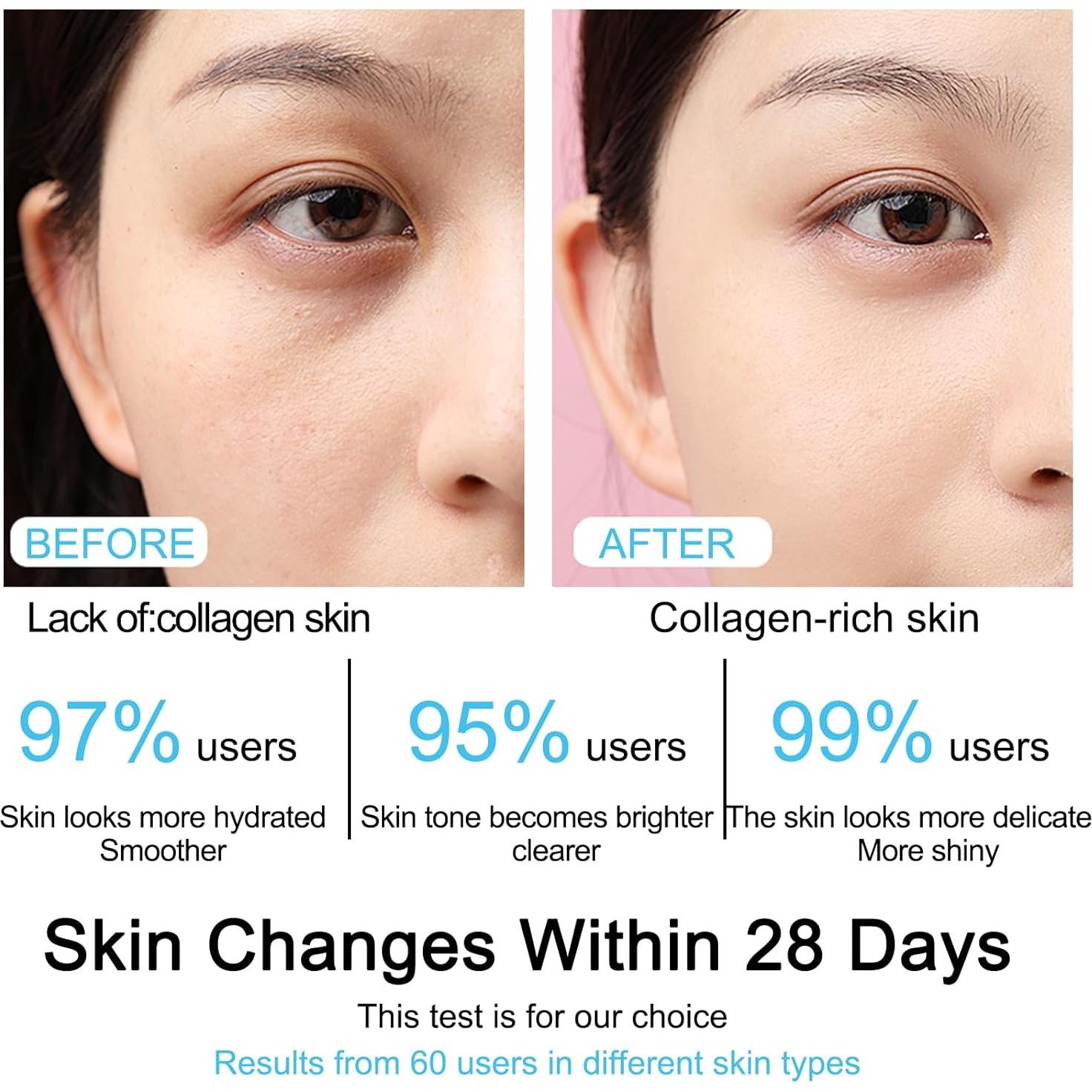 Suero Antienvejecimiento Ácido Hialurónico 5% SOYUB 30 Viales