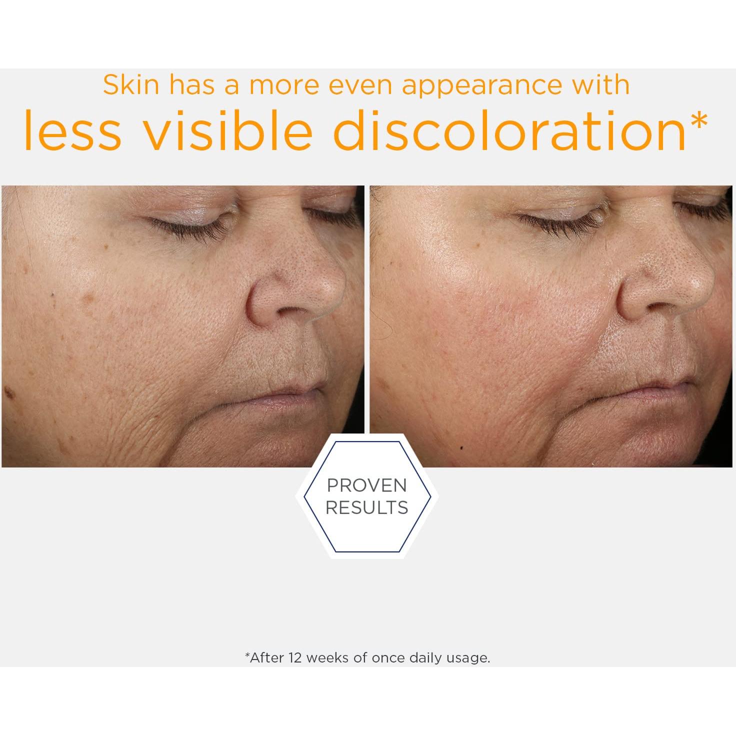 Suero Facial NEOSTRATA 15% Vitamina C 39.87g Iluminador