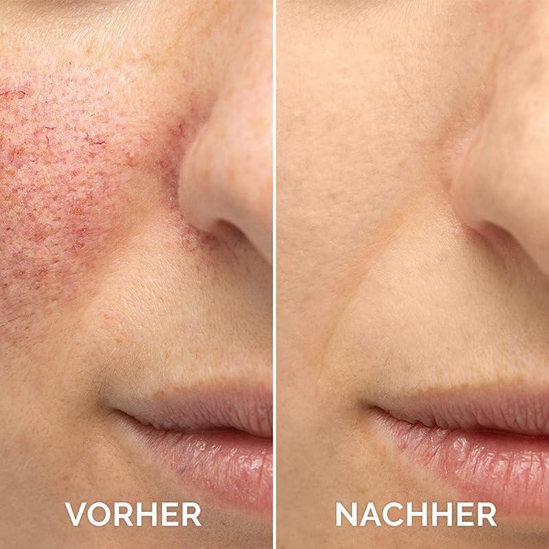 Suero Facial de Vitamina C y E THUIOP 30ml Hidratante