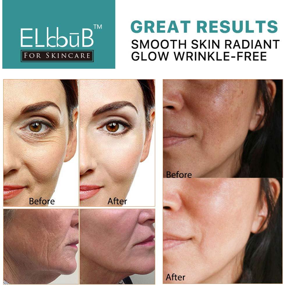 Suero Facial Anti Envejecimiento ELBBUB - Vitamina C y Retinol 30ml