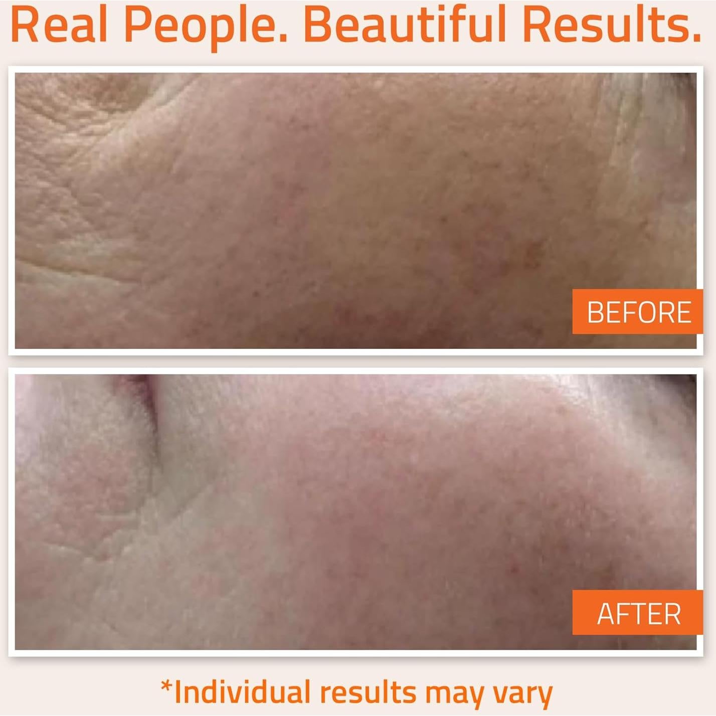 Suero Facial YEOUTH Vitamina C 59 ml con Ácido Hialurónico