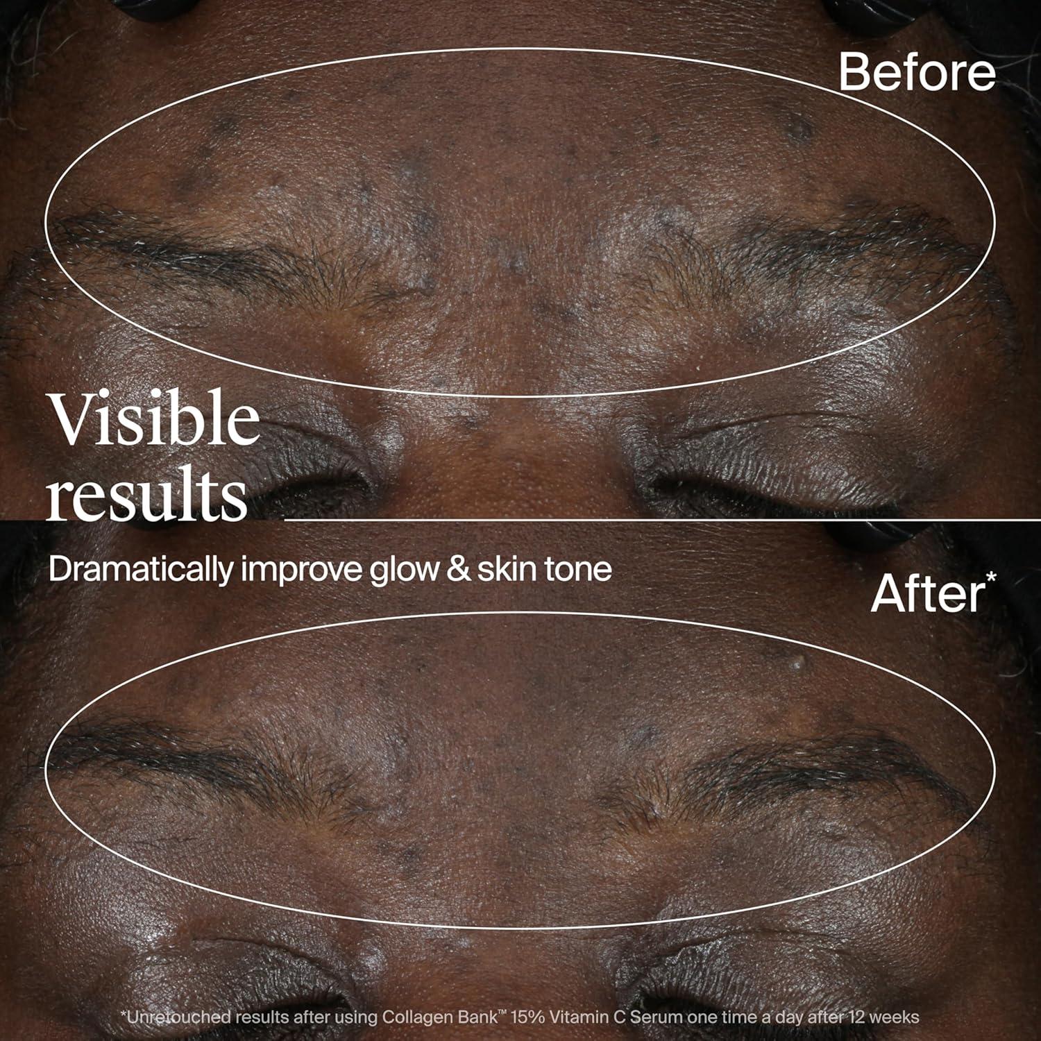 Suero Facial Neutrogena Collagen Bank 15% Vitamina C 14.79 ml