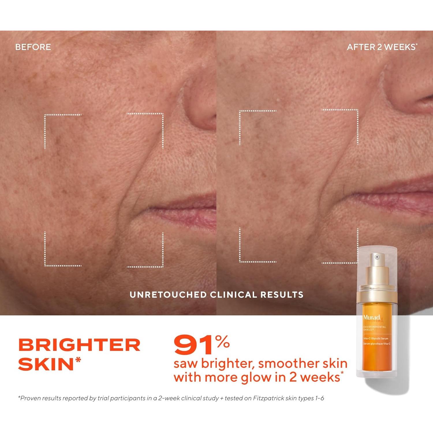 Suero Facial Avanzado Murad Vita-C Glycolico 30 ml