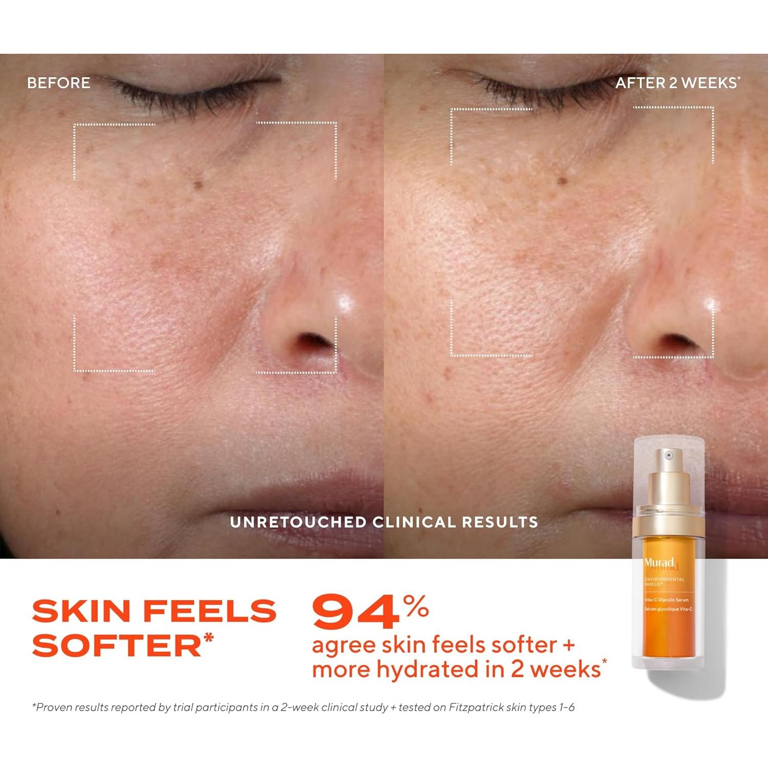 Suero Facial Avanzado Murad Vita-C Glycolico 30 ml