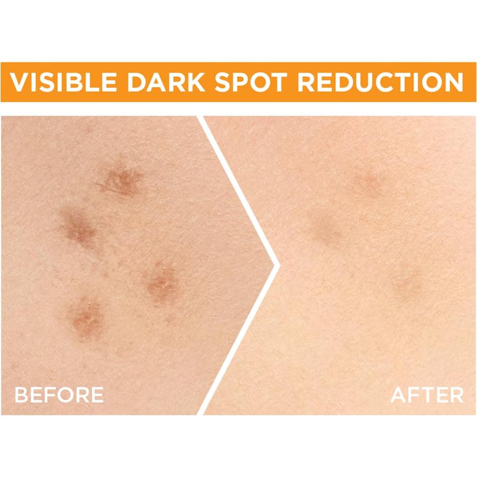 Sérum Facial Booster Vitamina C Garnier Bright Complete 30ml