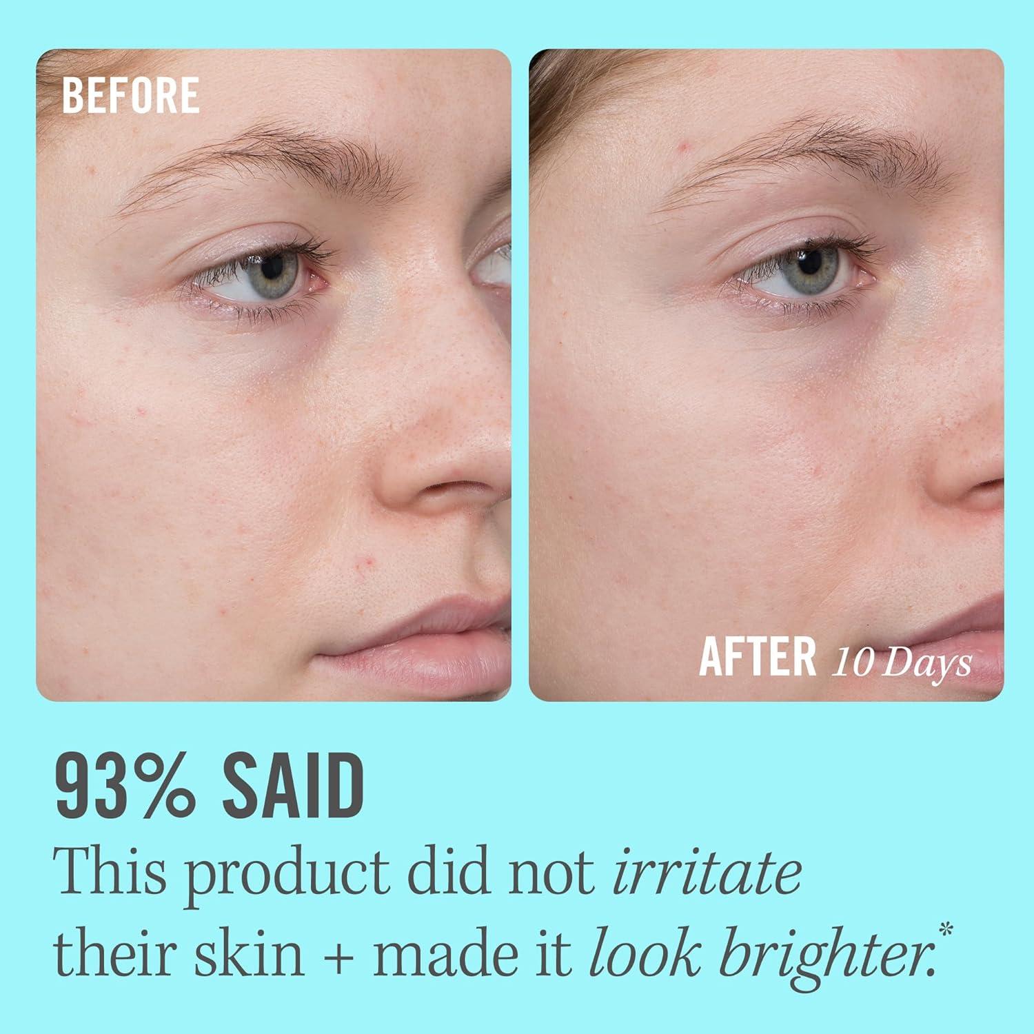 Suero Iluminador de Vitamina C 10% First Aid Beauty 48.2g