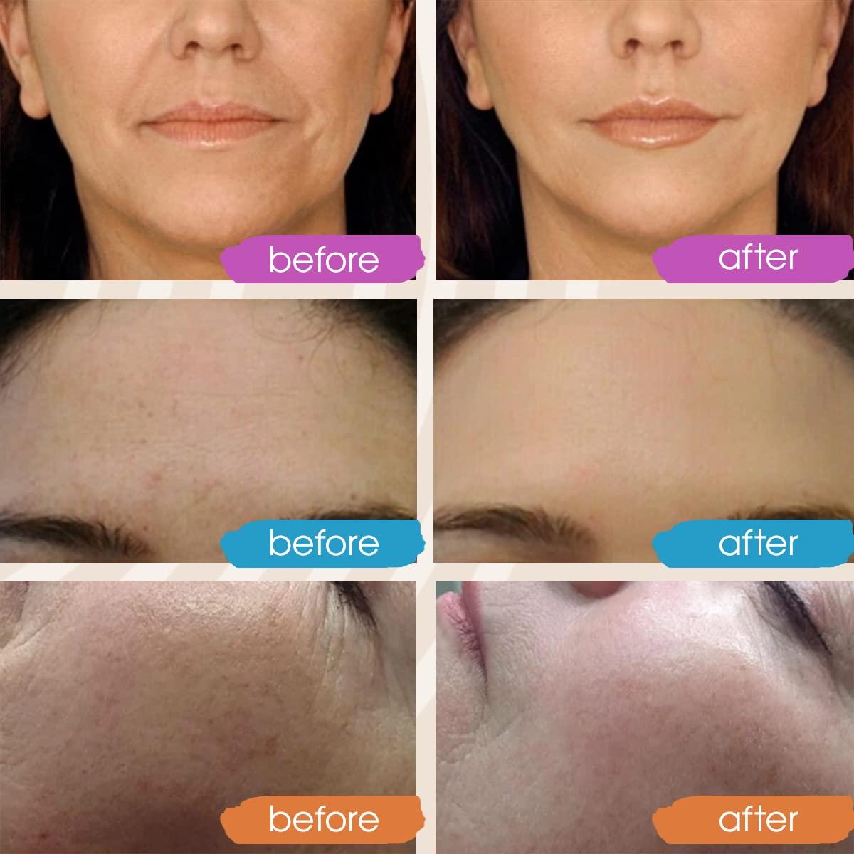 Suero Facial GLEOW Vitamina C y Ácido Hialurónico 56.7ml