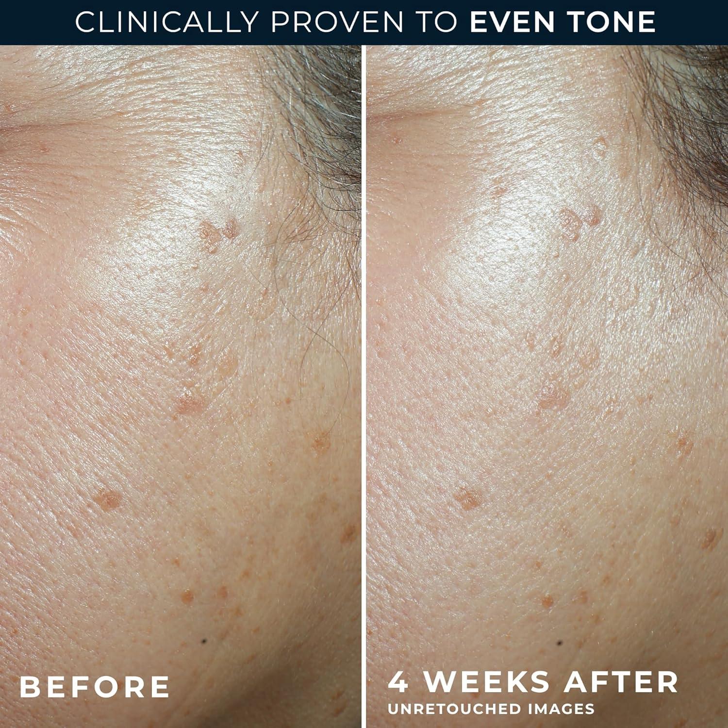 Hidratante Facial Anti-Envejecimiento RoC 5 en 1 SPF 30 108 g