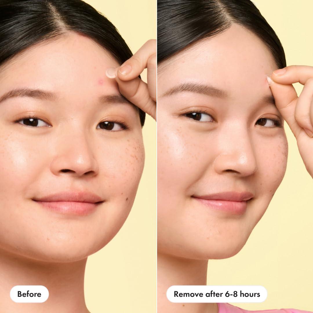 Mighty Patch Mini Invisible+ Parches Hidrocoloides 10mm - 30 Unidades