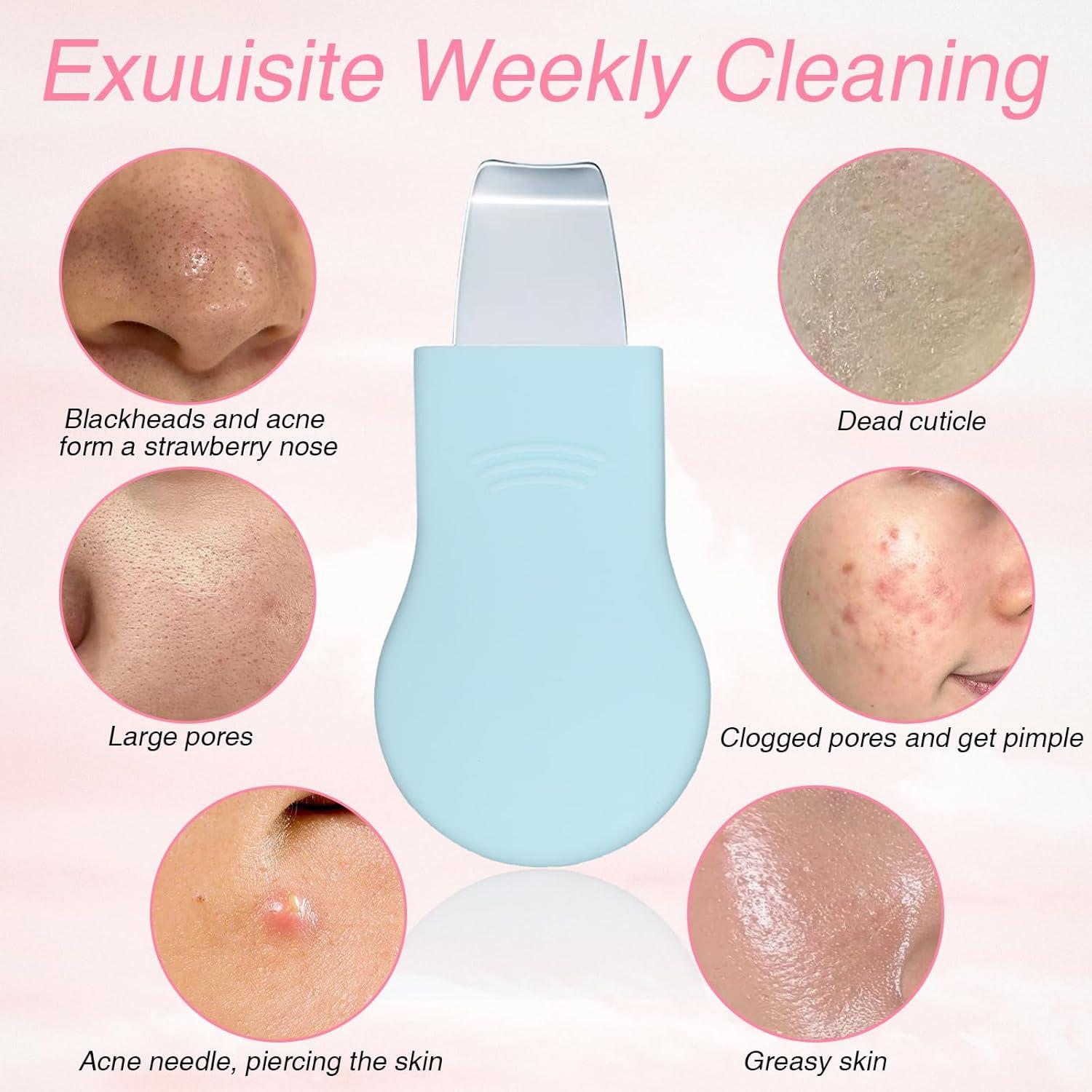 Juego de Herramientas para Puntos Negros LOGJAM 7 PZS