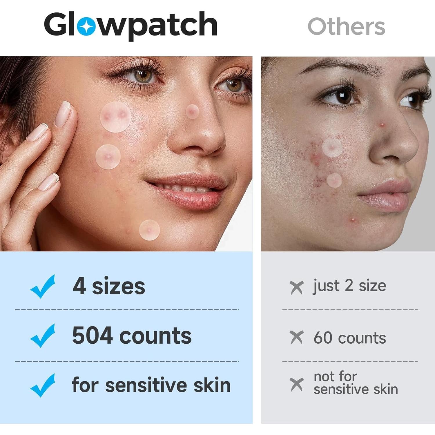 Parche para Granos Glowpatch 504 Unidades Hidrocoloide