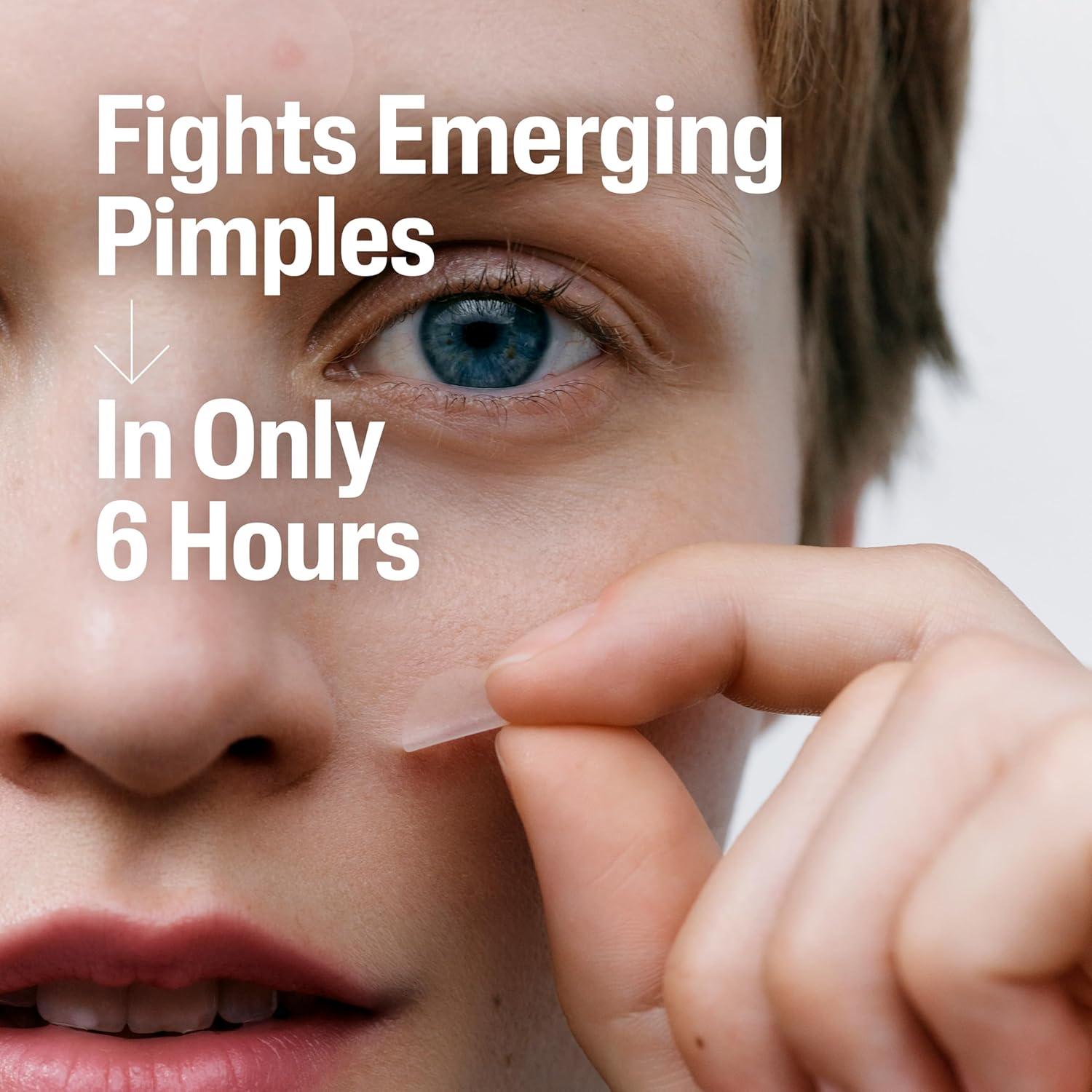 Parche para Acné Cetaphil Rescate Rápido - 24 Unidades