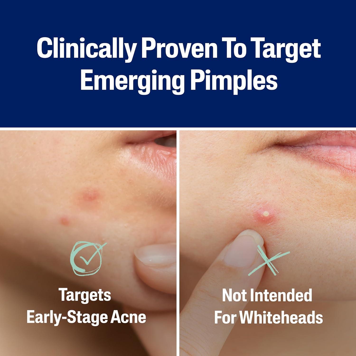 Parche para Acné Cetaphil Rescate Rápido - 24 Unidades