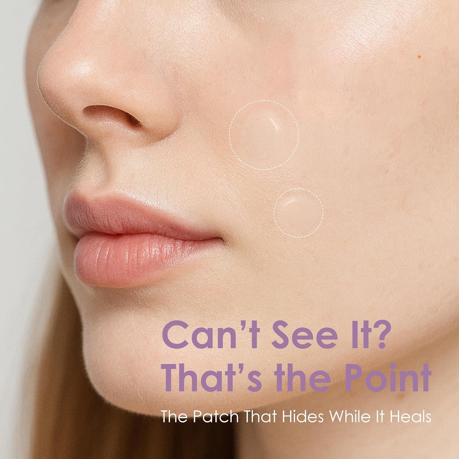 Parche Aliviador de Manchas Activas ASAP Glowiest - 44 Parches Hidrocoloide