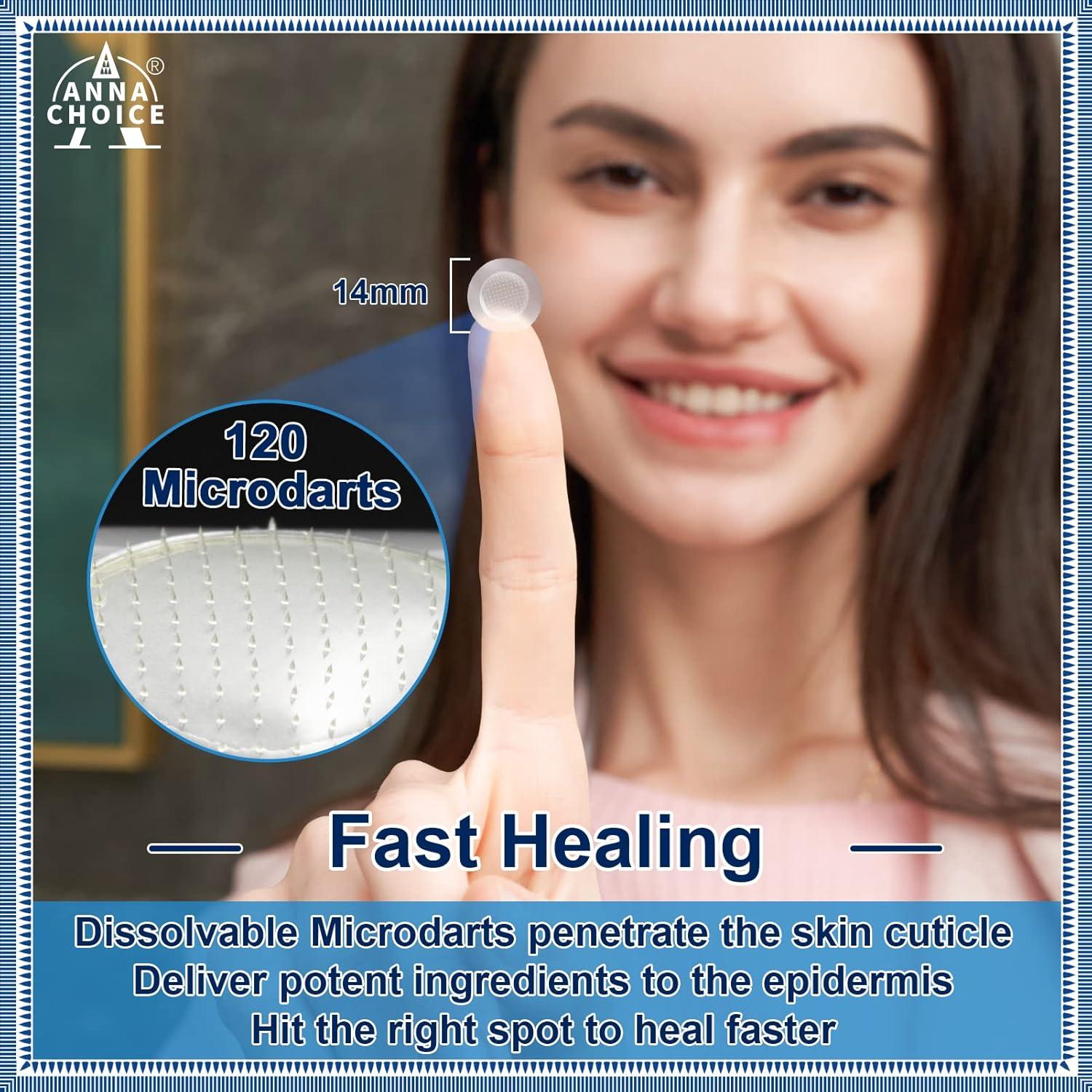 Parche Hidrocoloide para Acné AnnaChoice - 18 Parches 14mm