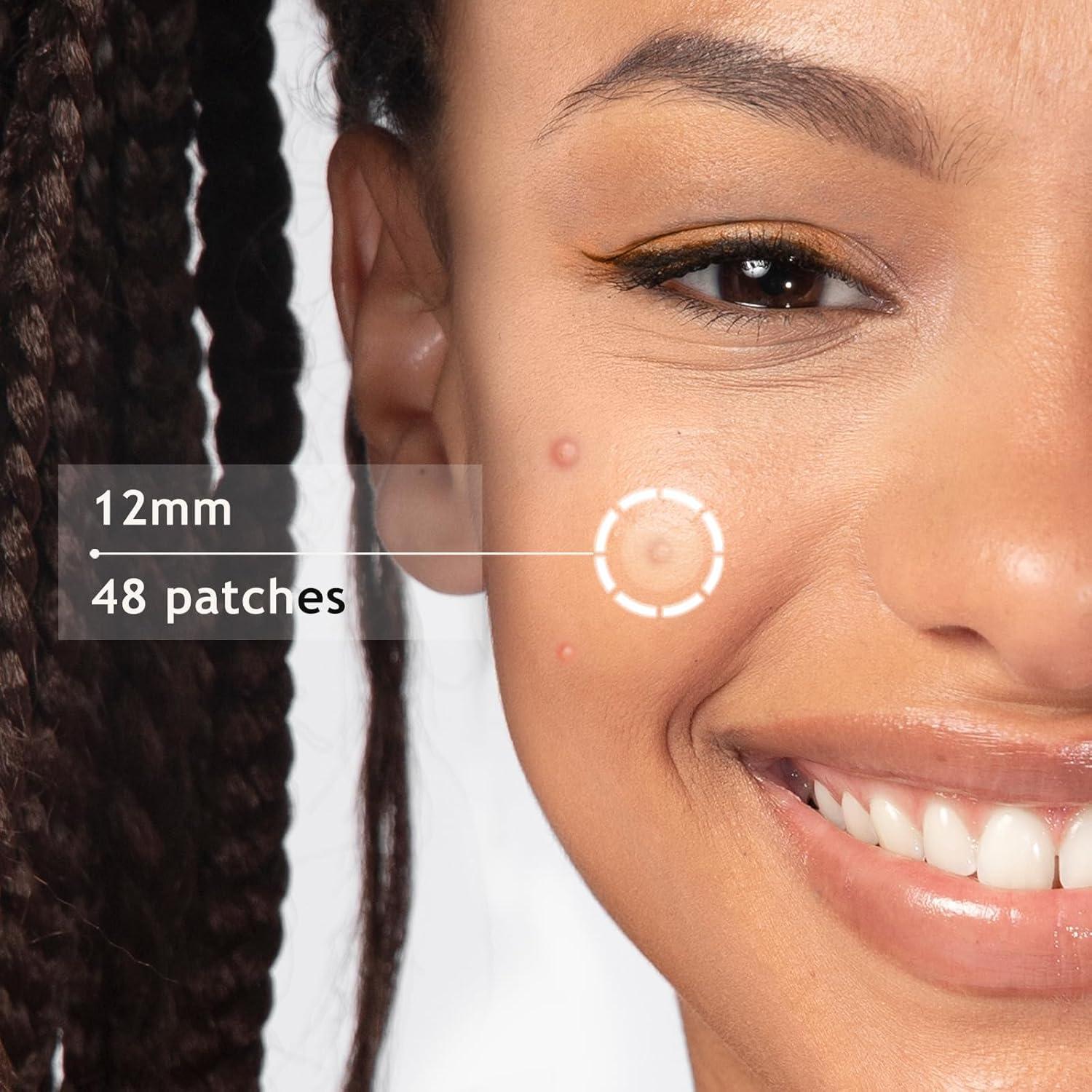 Parche Dazzlook para Granitos con Ácido Salicílico - 48 Unidades