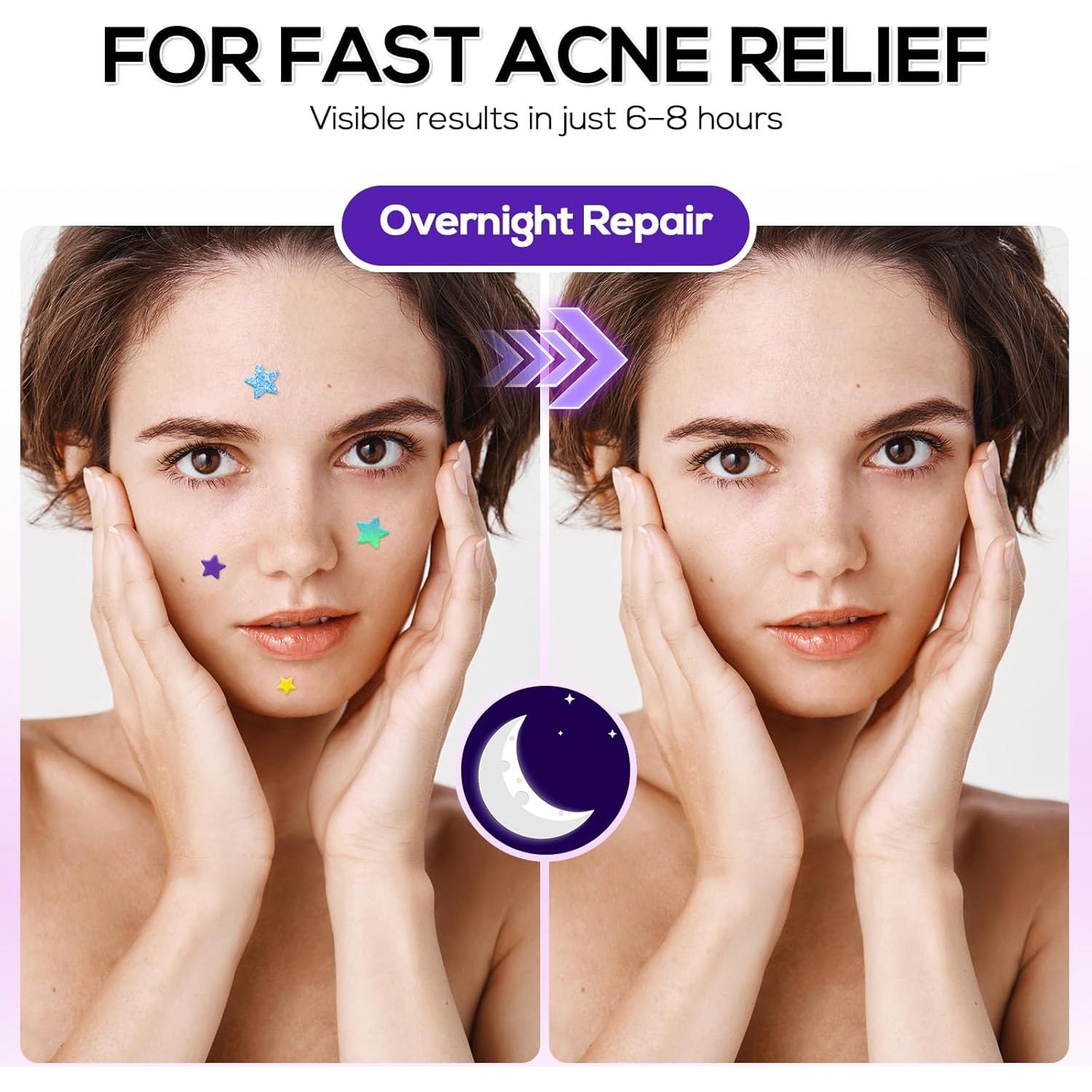 Parche Hidrocoloide para Acné Star 360 VOZRO - 10mm, 12mm, 14mm